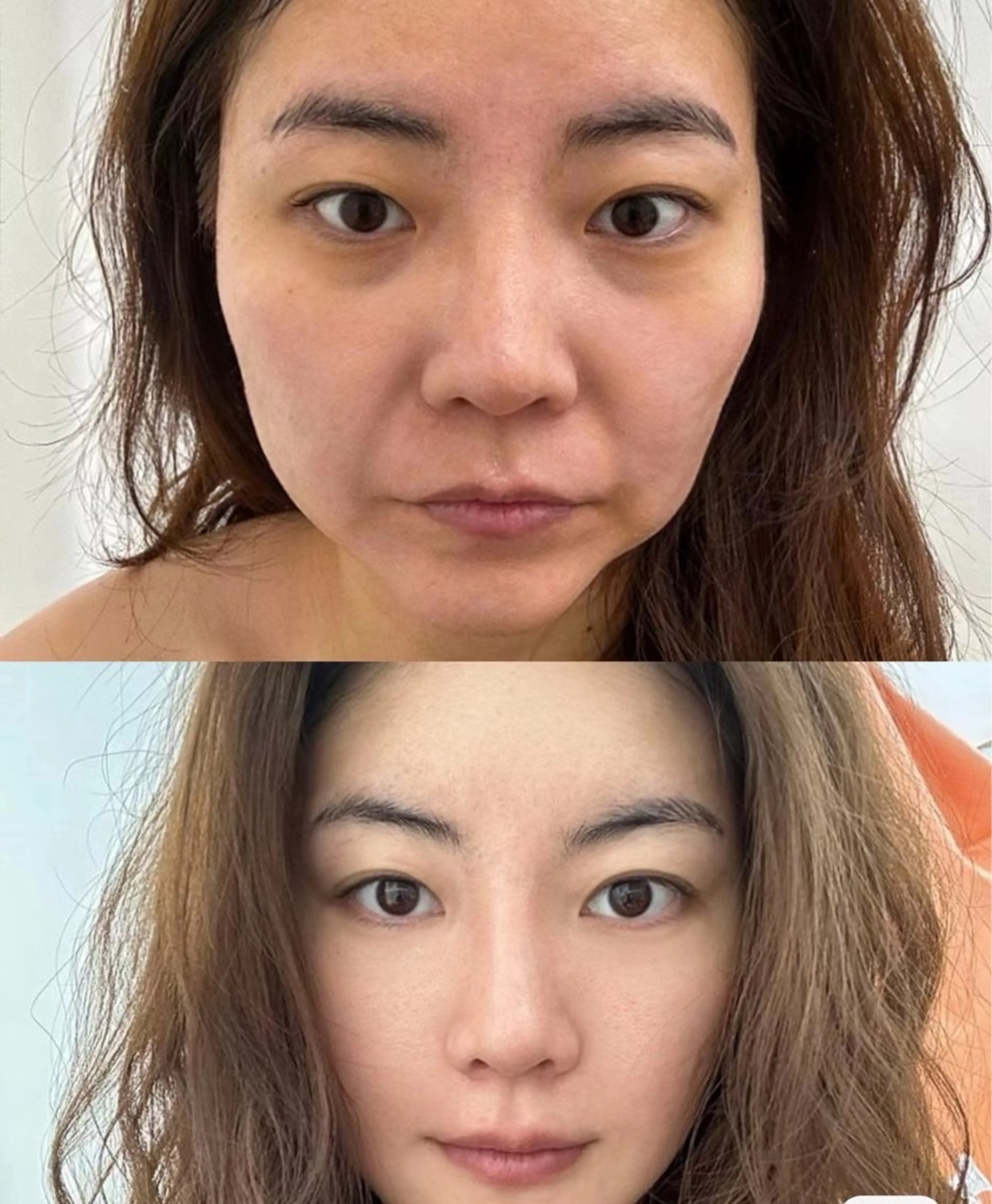 マツエク・マツパ 結婚式・ブライダル エステ aliaハイフ&水光ジェットサロン所属・aliaハーブ水光店 エステティシャン募集のエステ・リラクイメージ