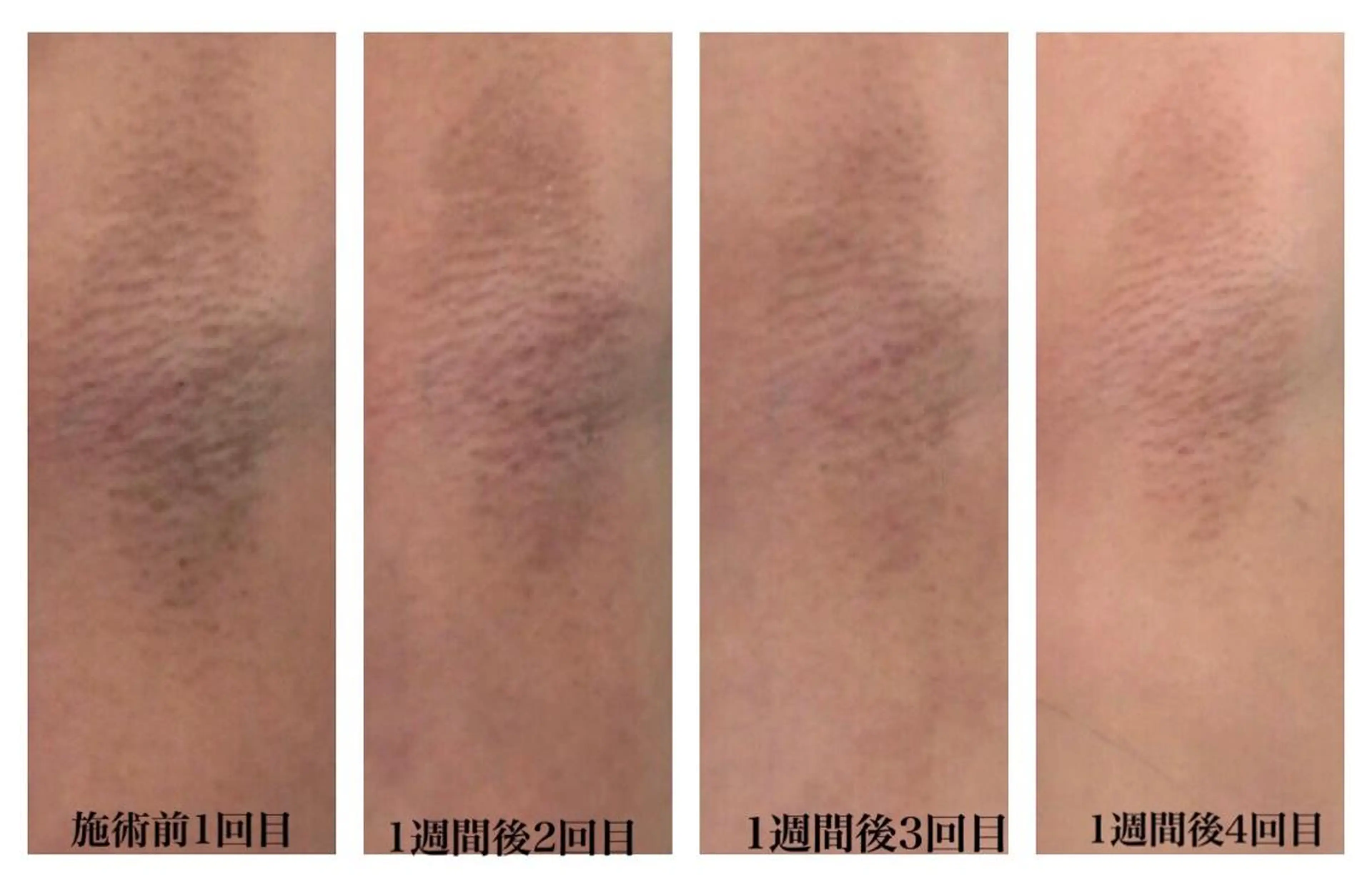 ビューティー ミロワールのエステ・リラクイメージ