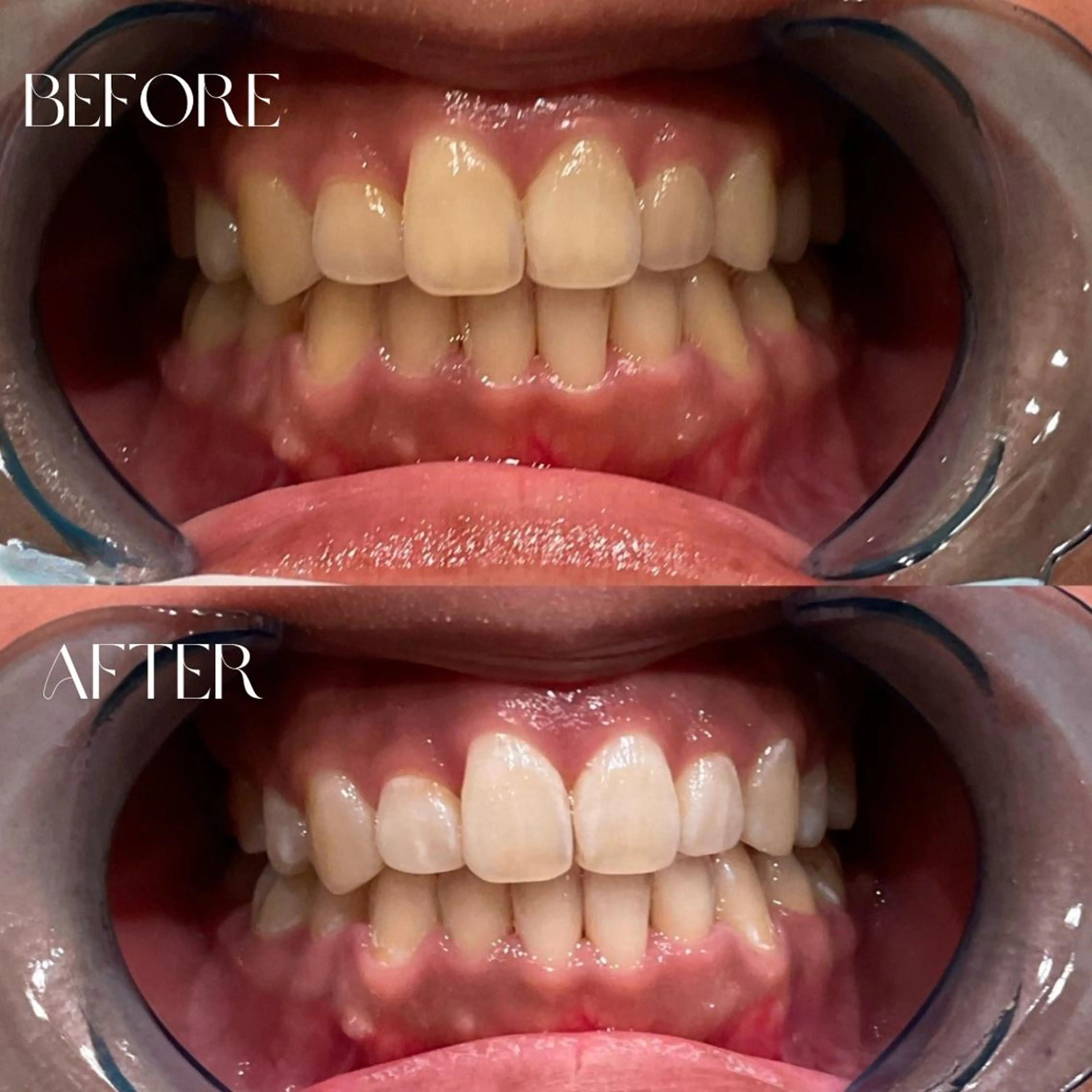 その他 B-st. 下北沢のエステ・リラクイメージ