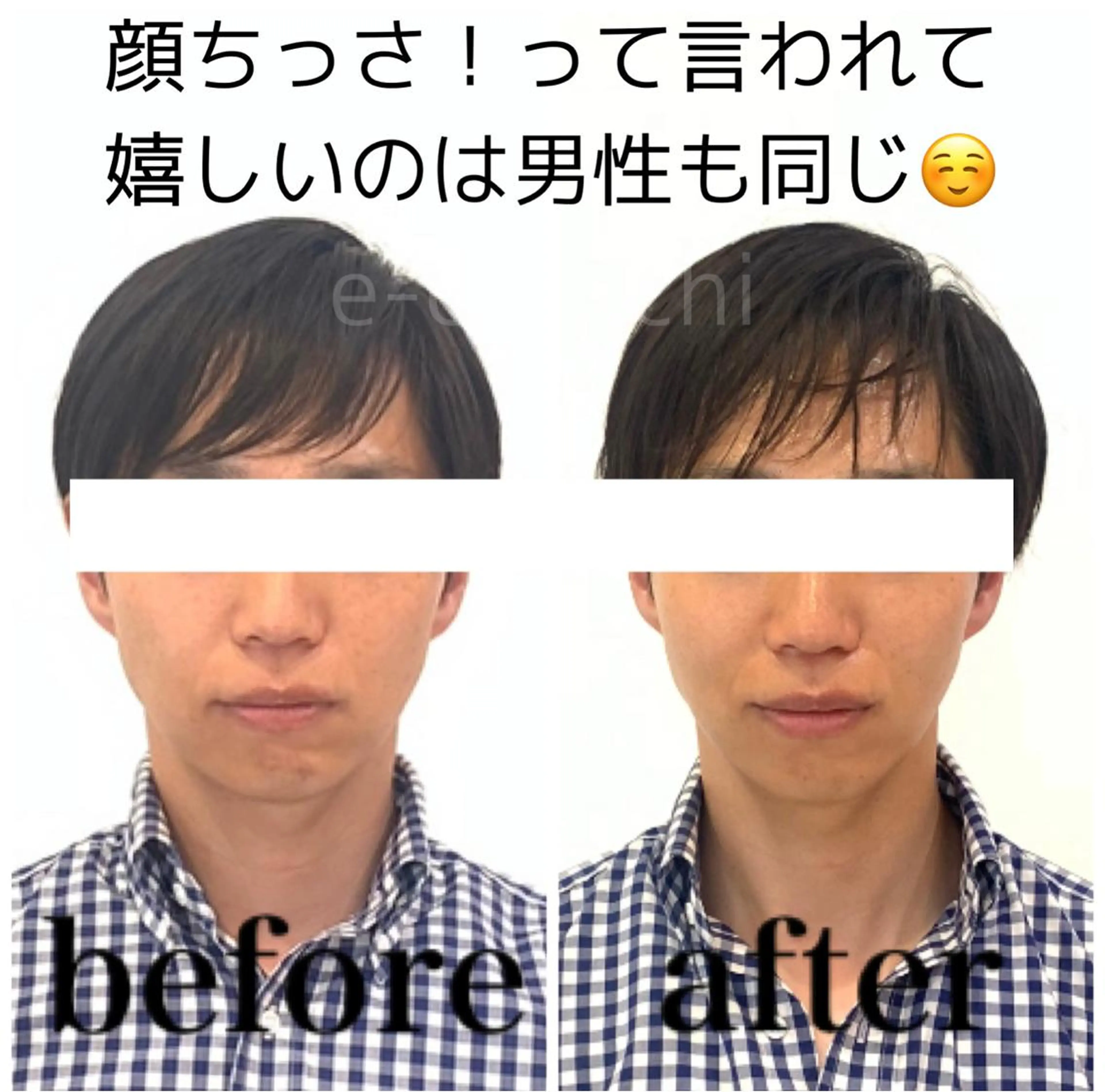 エステ 小顔と ヘッドスパのお店のエステ・リラクイメージ