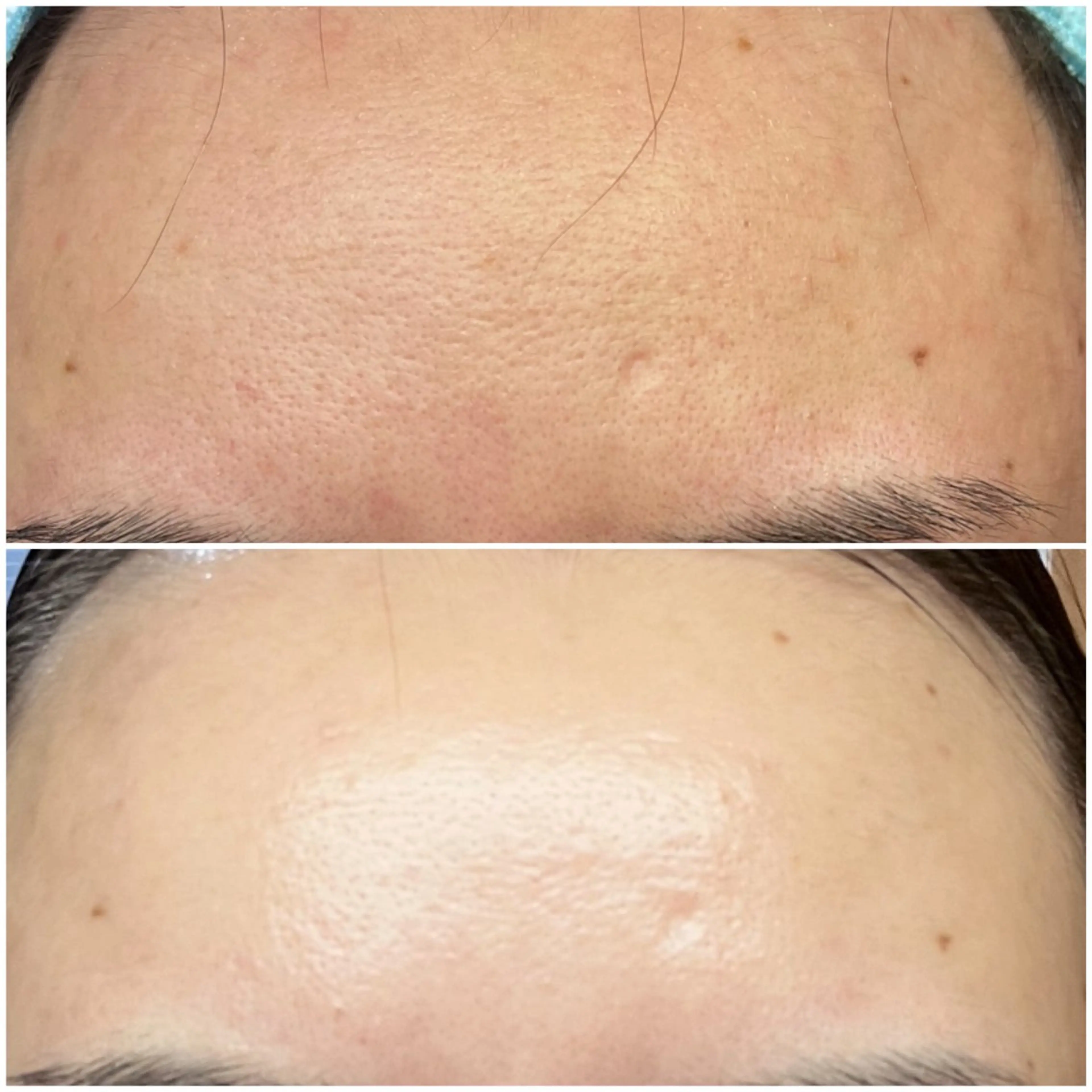 エステ MELIA the beauty所属・肌のお悩み改善サロン MELIA/朋美のエステ・リラクイメージ