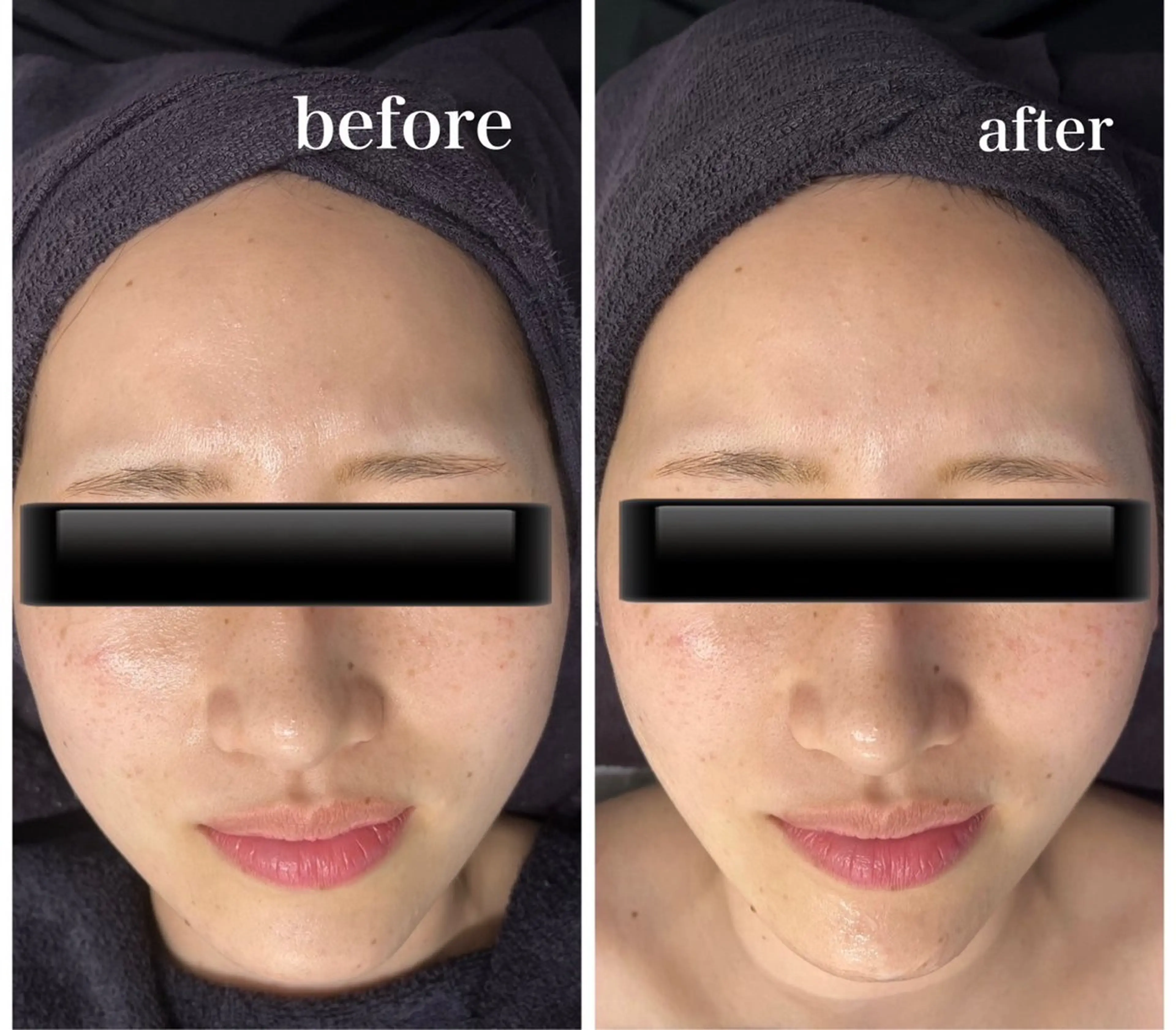 Genesis Plus大津京店のエステ・リラクイメージ