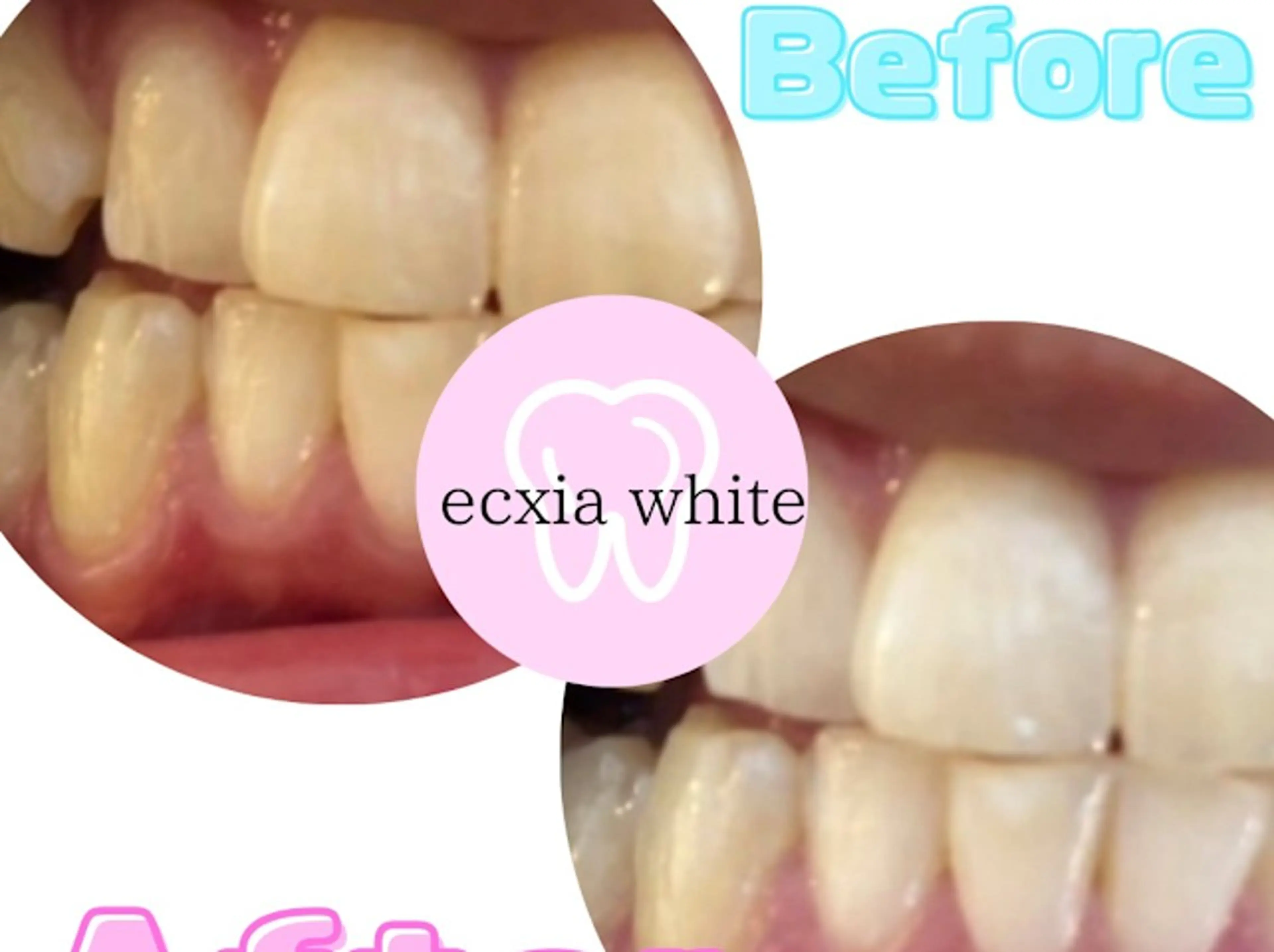 エステ セルフホワイトニング エクシア浜松店のエステ・リラクイメージ