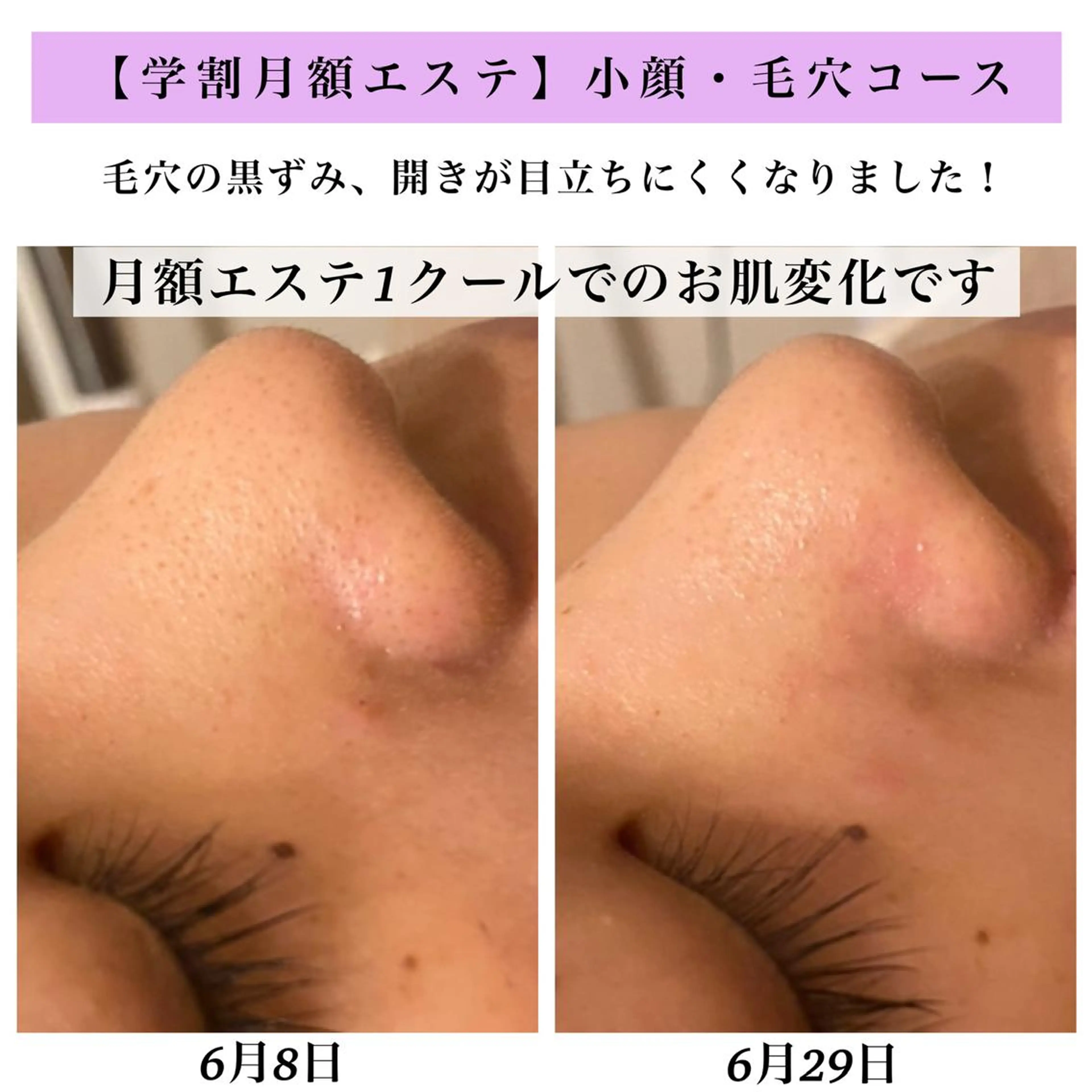 Bellesthe （ベルエステ）のエステ・リラクイメージ