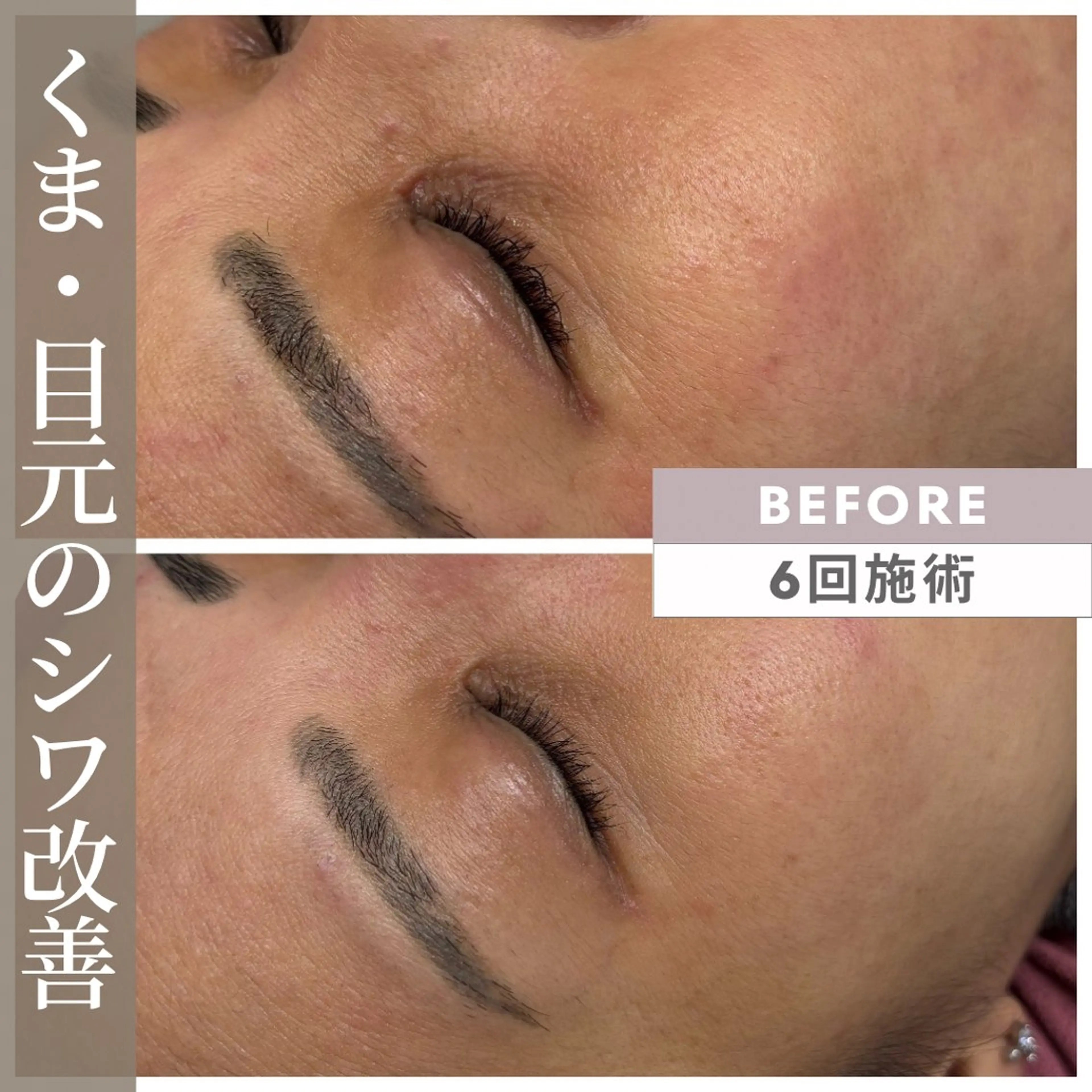 エステ 小顔矯正専門店 【RED】池田のエステ・リラクイメージ