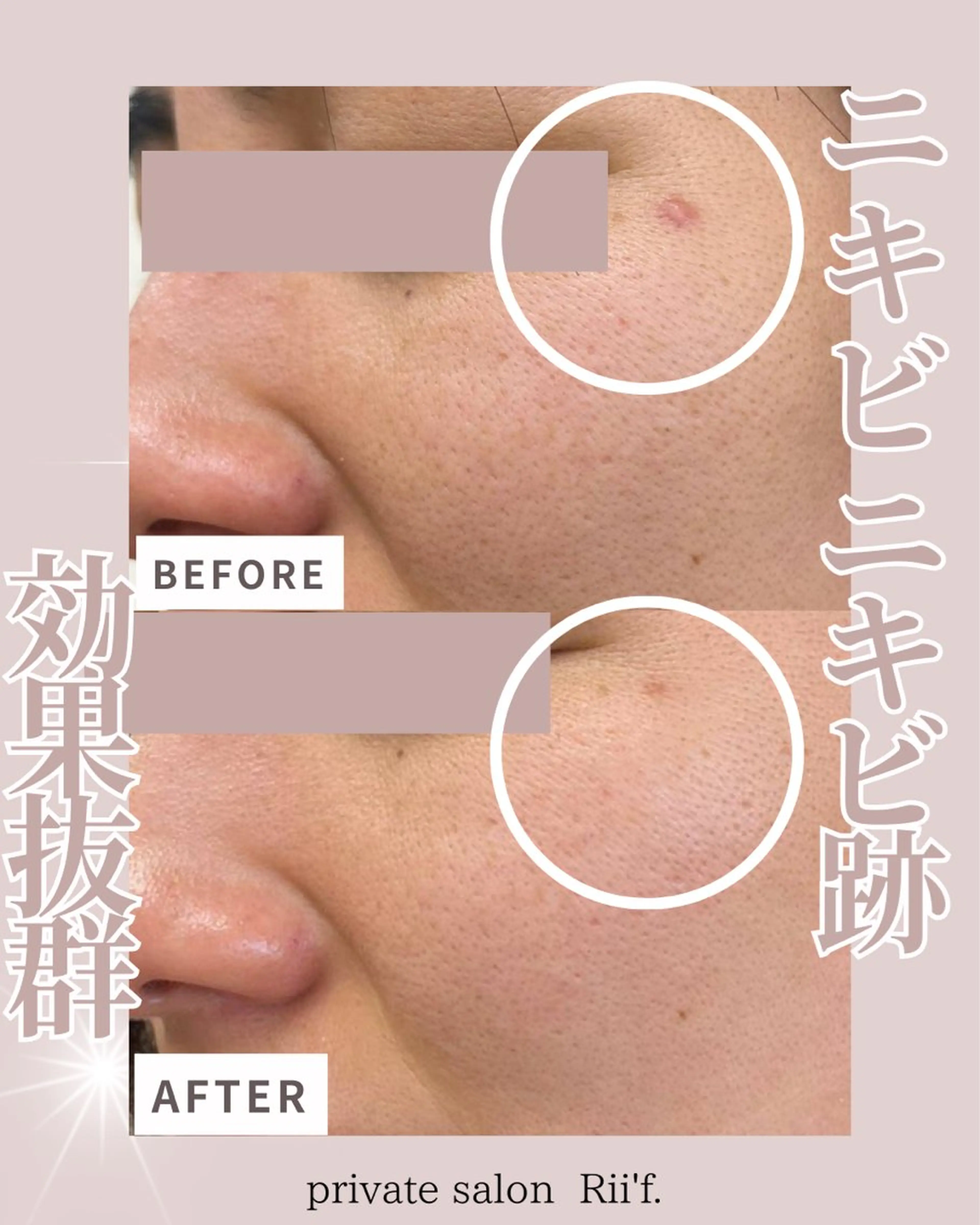 エステ private salon Rii'f.所属・private sa lon Rii'f.のエステ・リラクイメージ