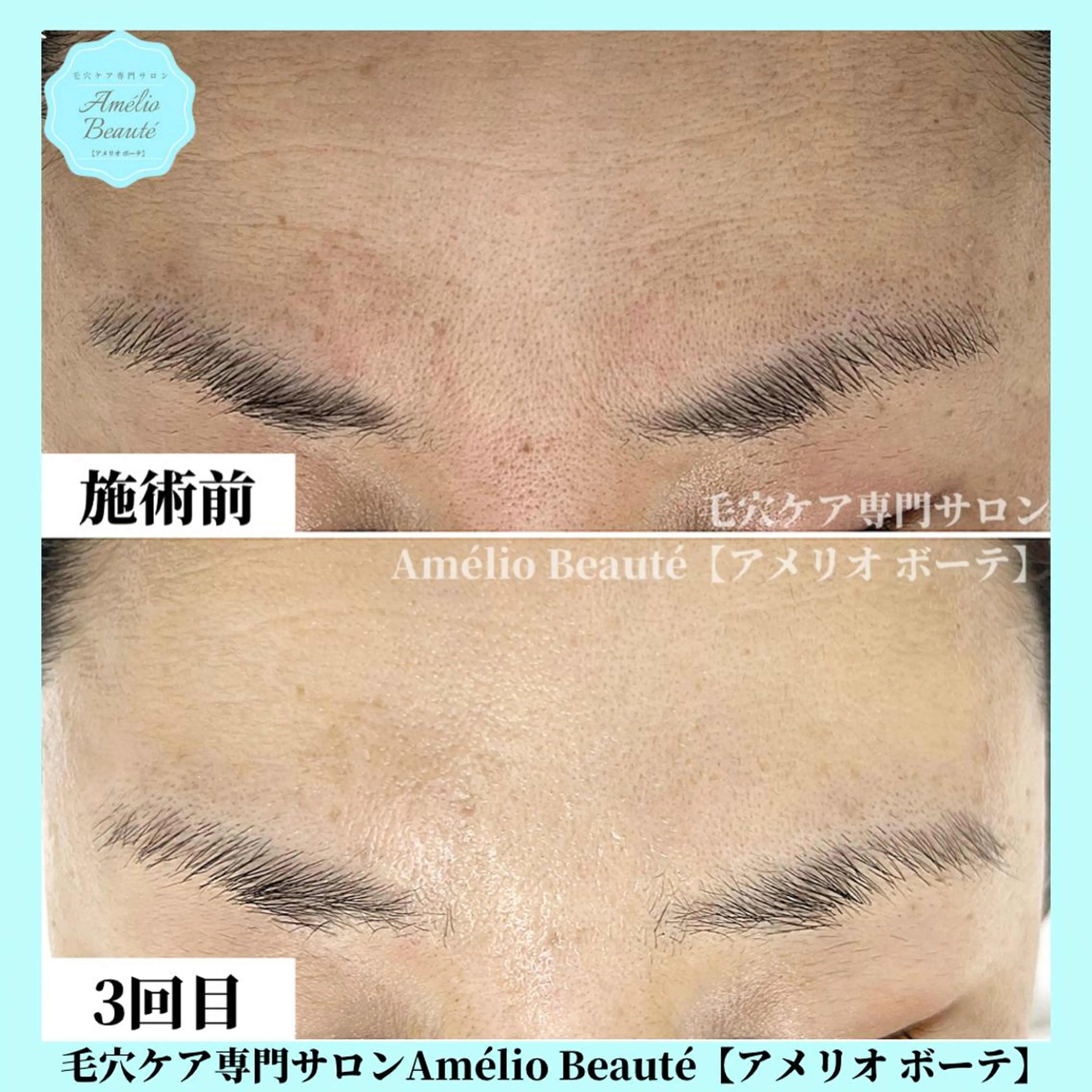 毛穴ケア専門サロン Amélio Beauté所属・毛穴ケア専門サロン アメリオボーテのその他イメージ