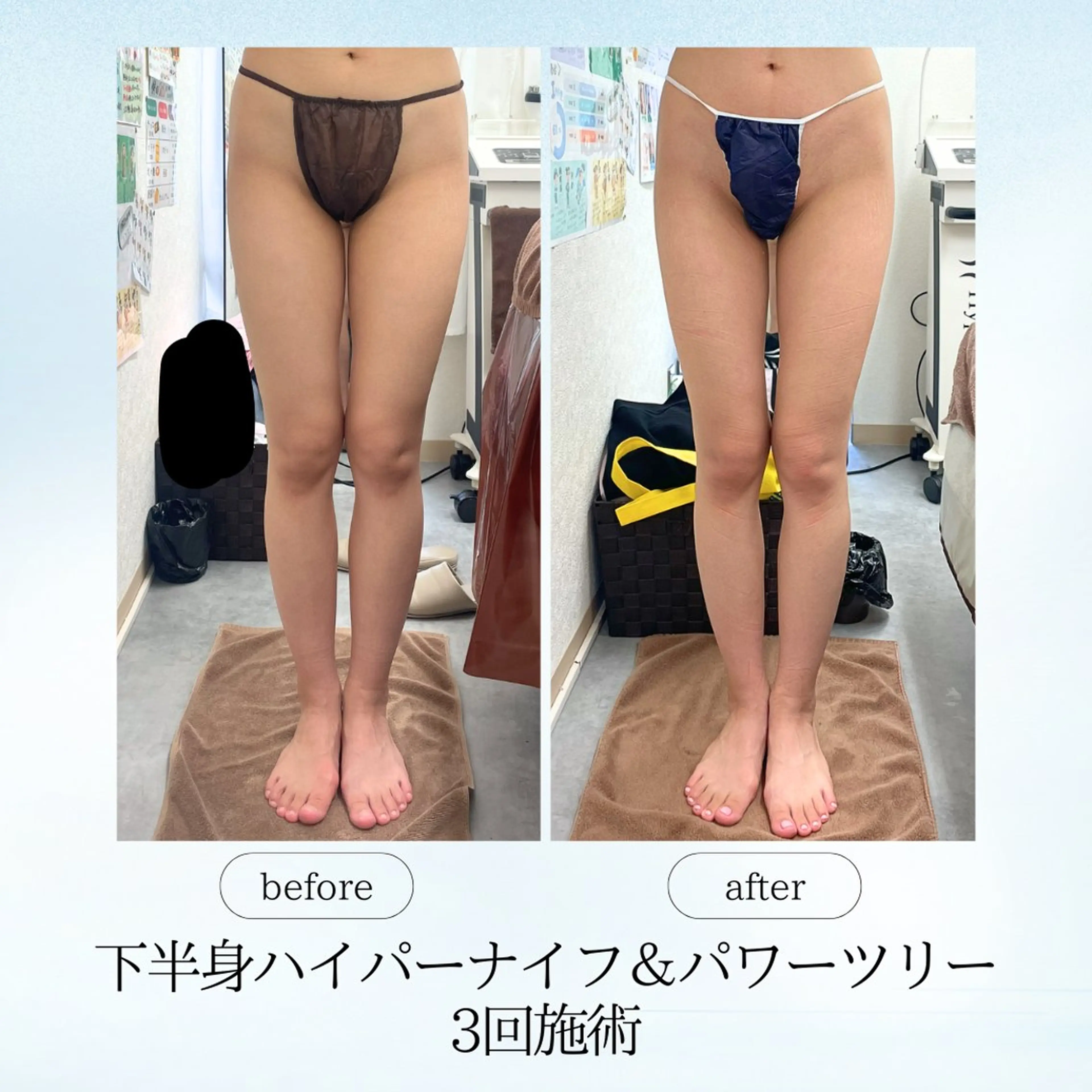 エステ リラク espresso,所属・《痩身、小顔専門店》 エスプレッソのエステ・リラクイメージ