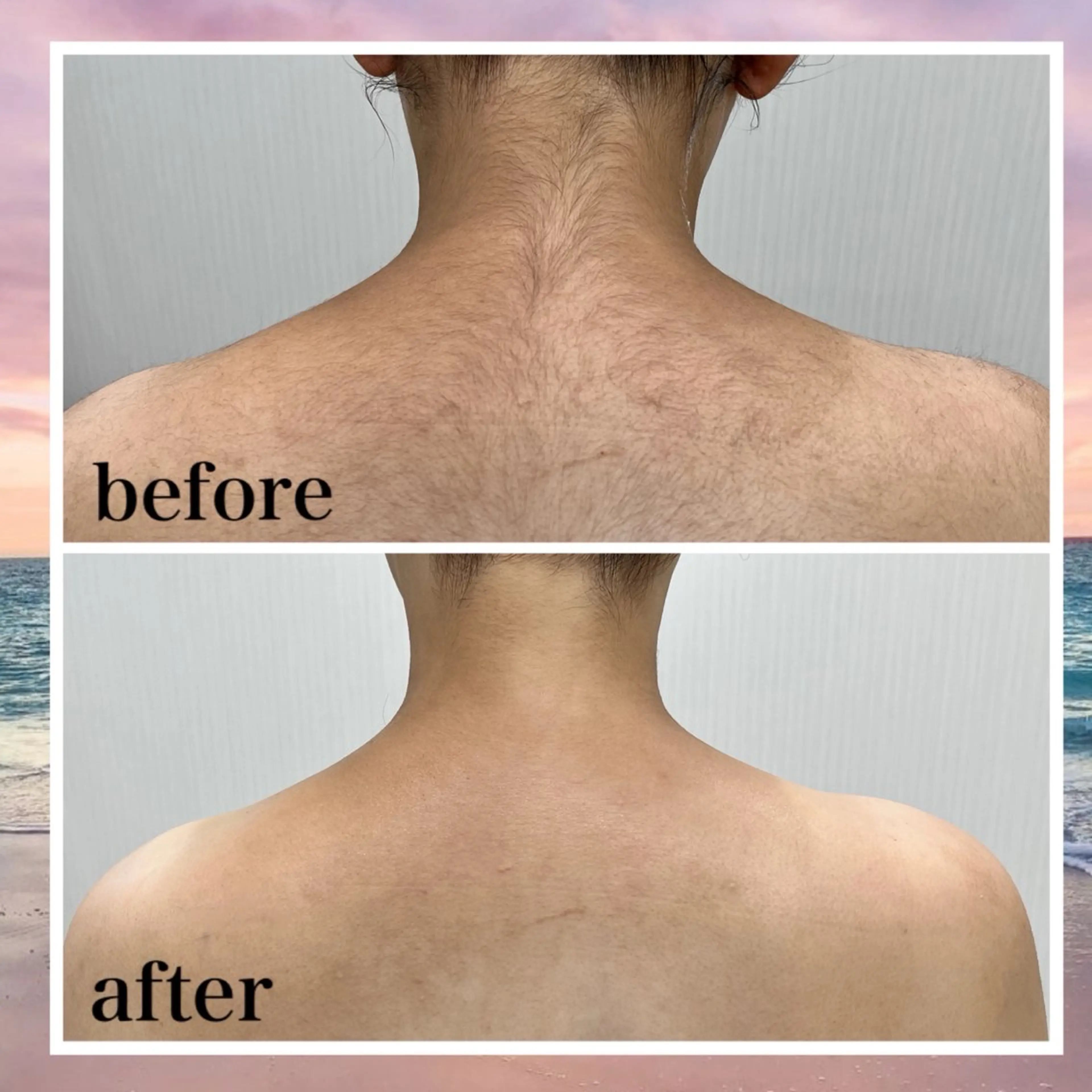 【顔うなじ、背中、デコルテ、両腕肩から指先まで】の写真