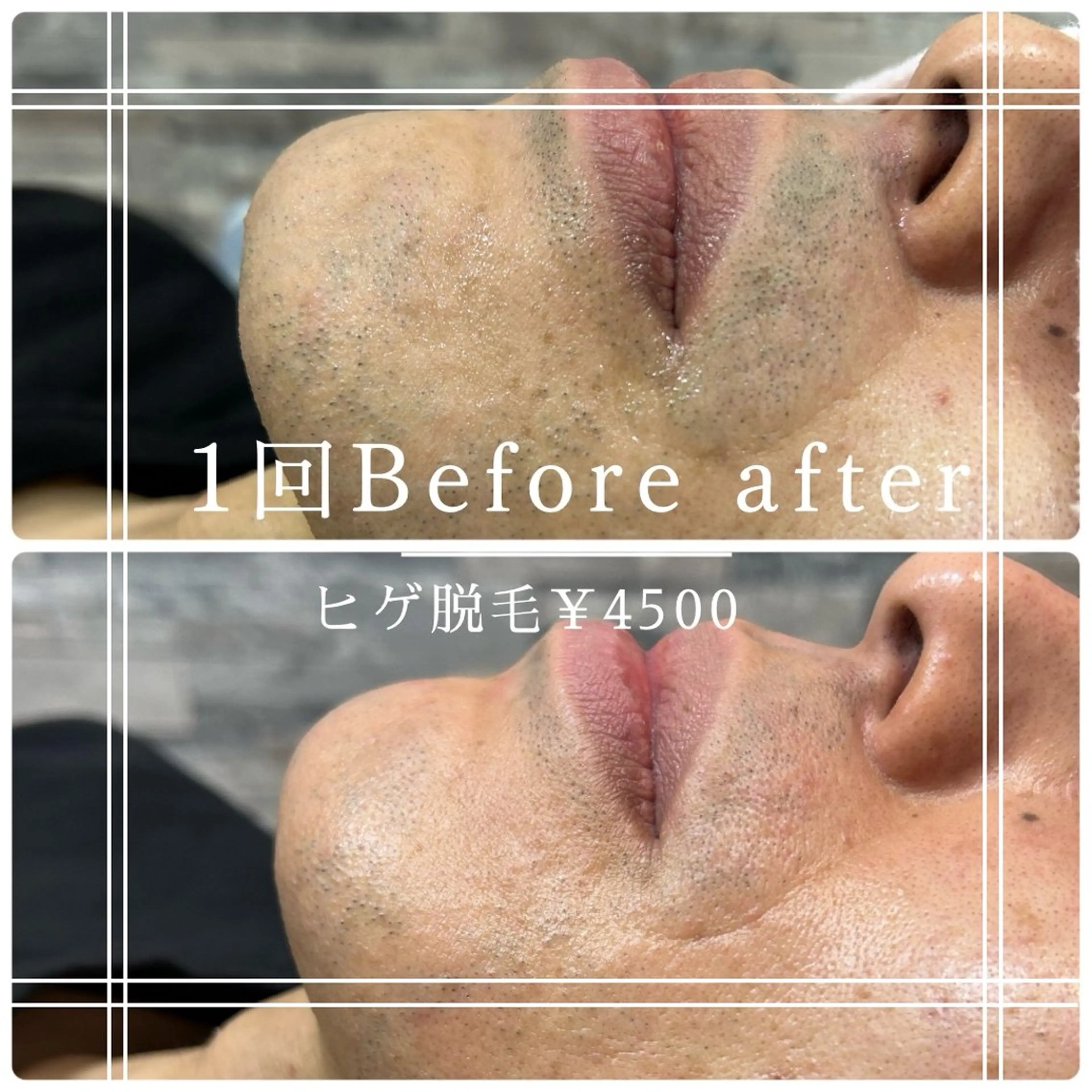 メンズ 脱毛 片田 ゆいのエステ・リラクイメージ