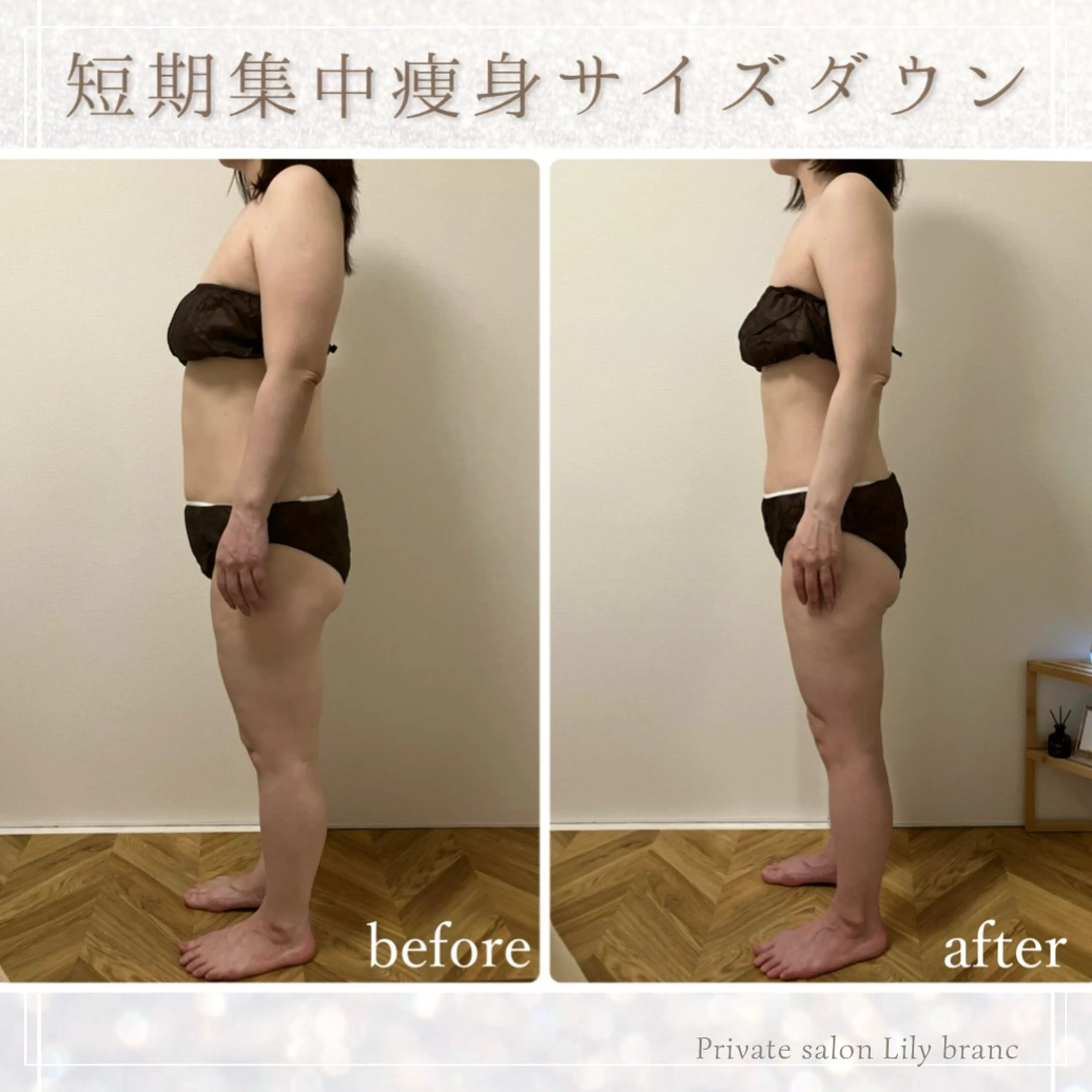 Lily branc 痩身/小顔/肌質改善のエステ・リラクイメージ