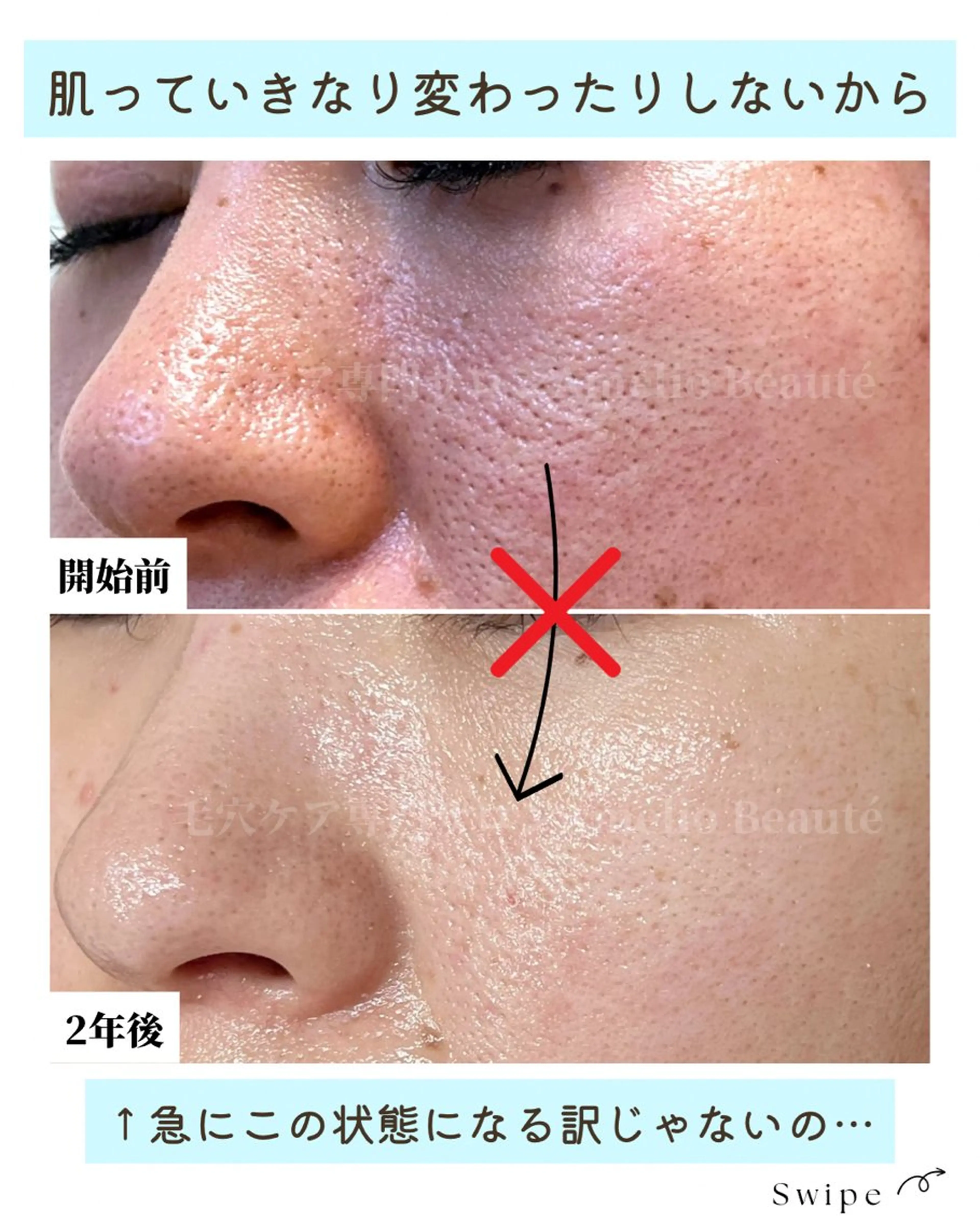 毛穴ケア専門サロン Amélio Beauté所属・毛穴ケア専門サロン アメリオボーテのその他イメージ