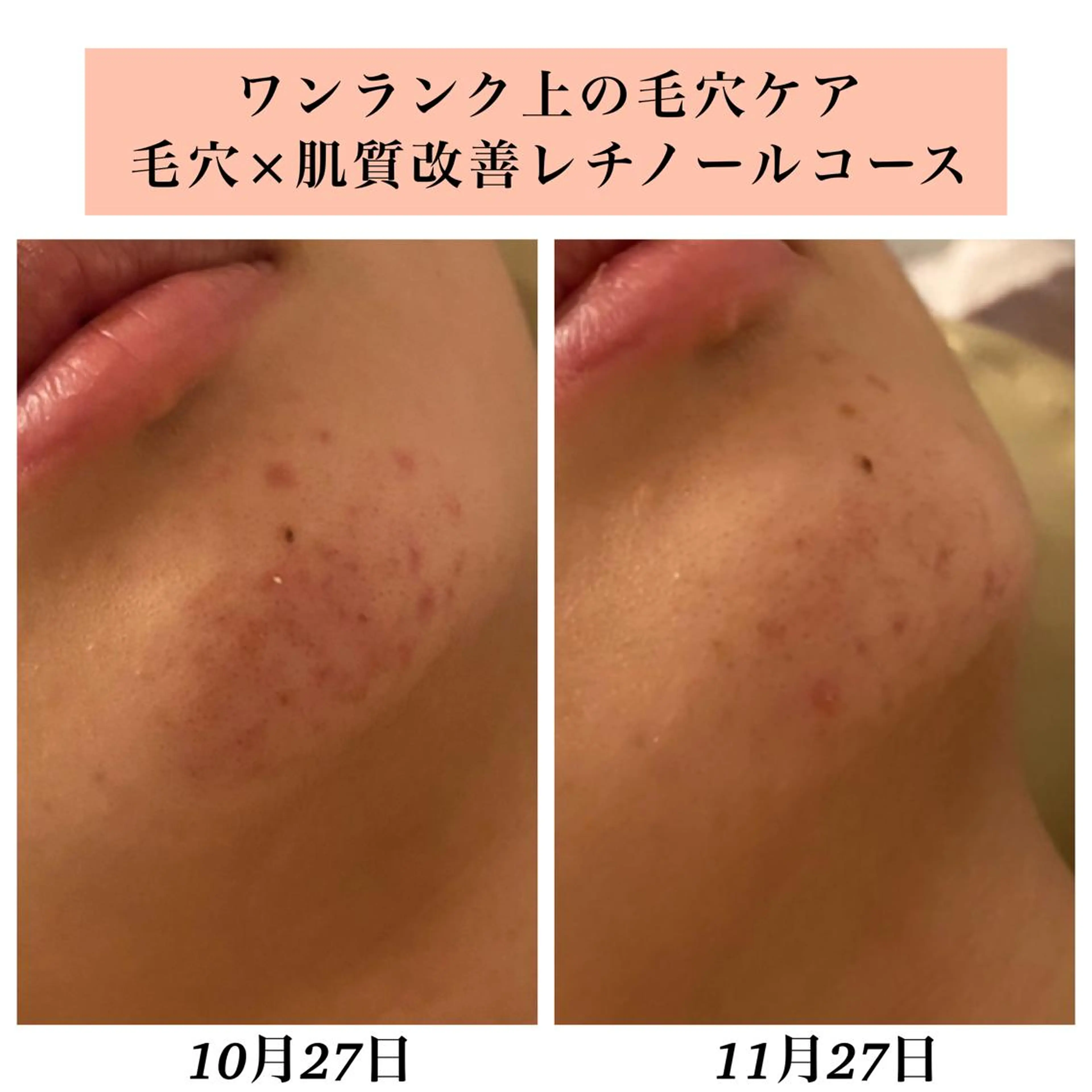 エステ リラク Bellesthe （ベルエステ）のエステ・リラクイメージ