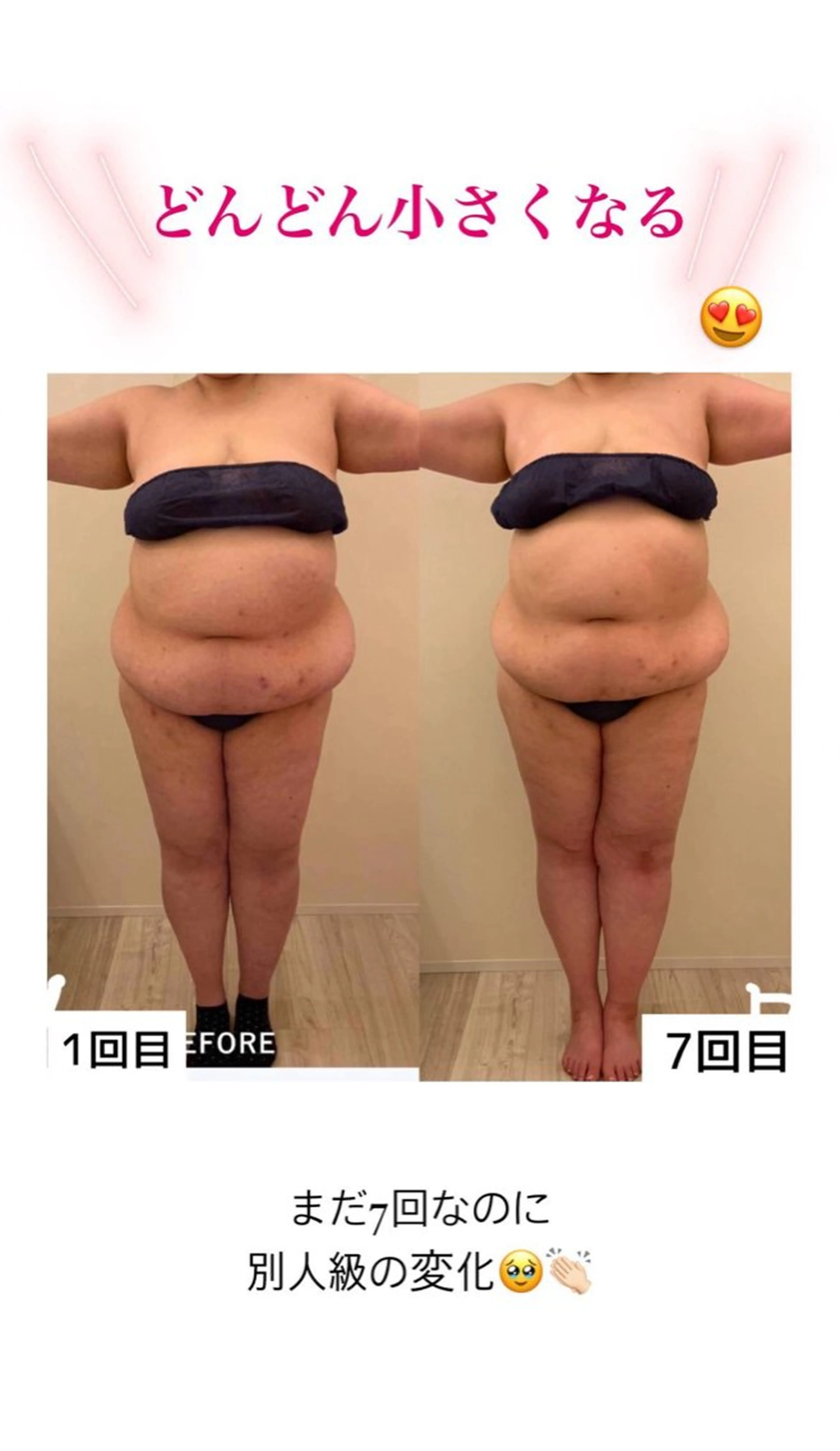 産後ダイエット−9㎏ Pourvous結衣のエステ・リラクイメージ