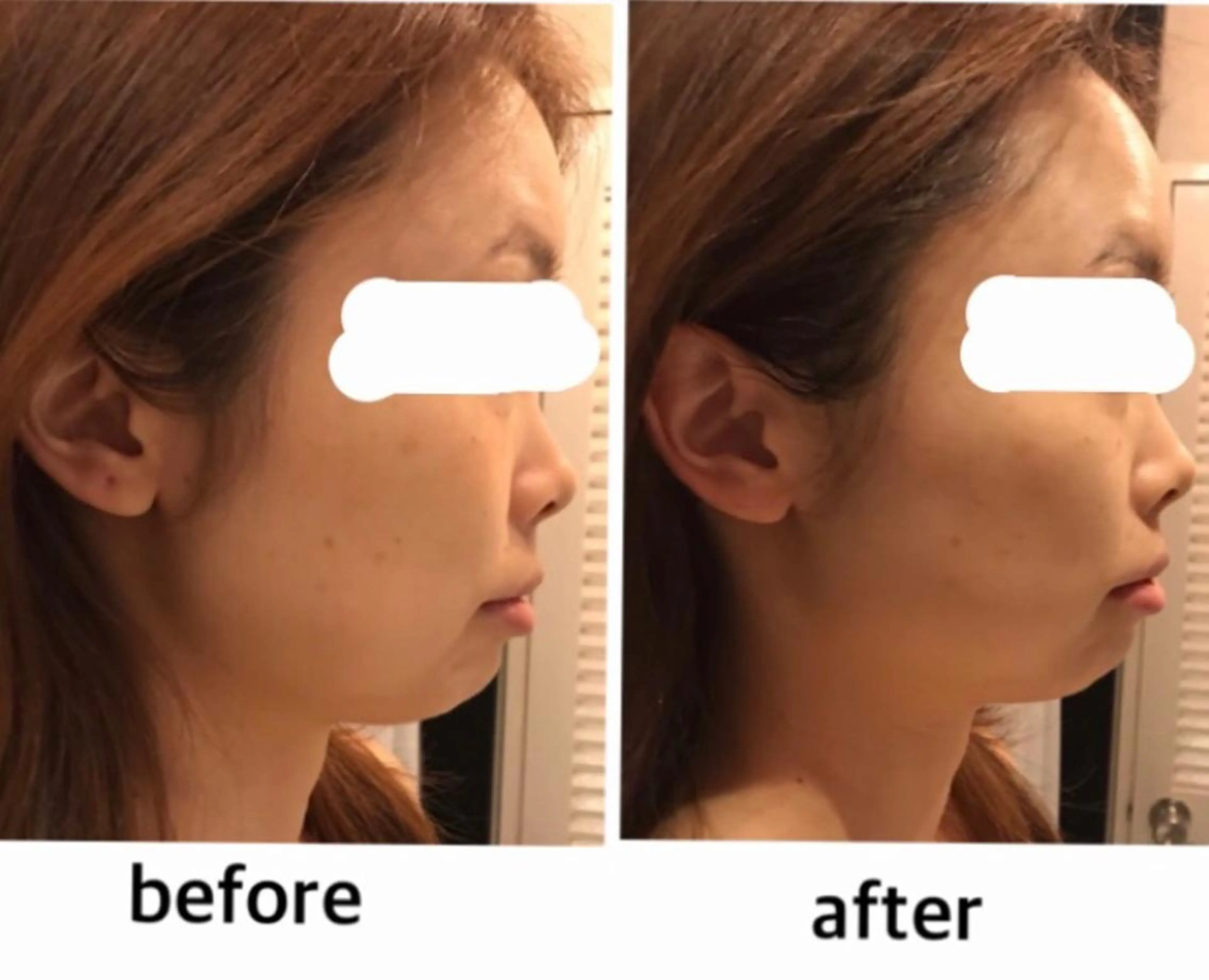 アクシア ビューティー サロン所属・究極のアンチエイ ジングサロンのエステ・リラクイメージ