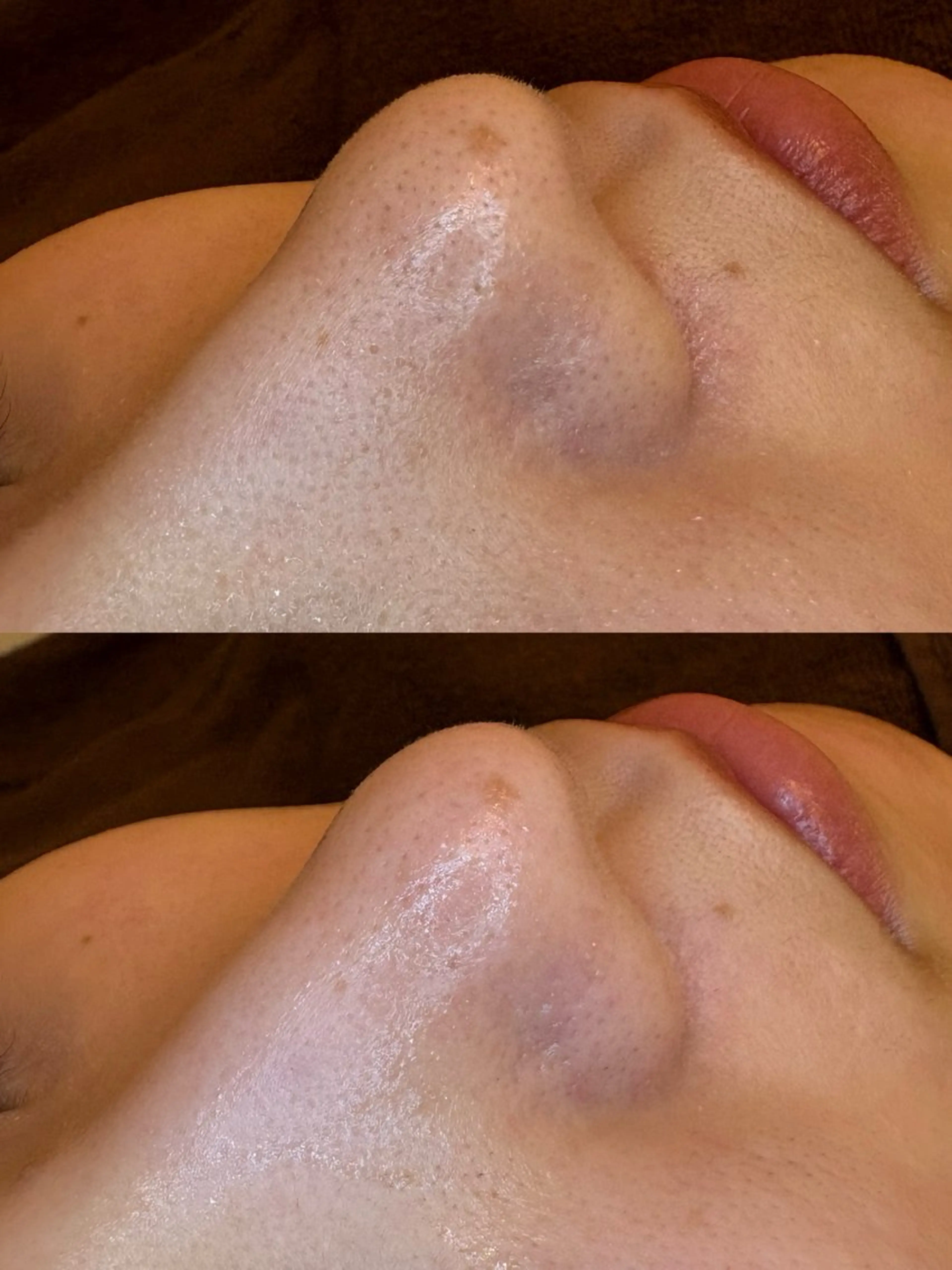 エステ EARTH coiffure beaute 新潟紫竹山店所属・🤍アベシュリ /フェイシャル🤍のエステ・リラクイメージ