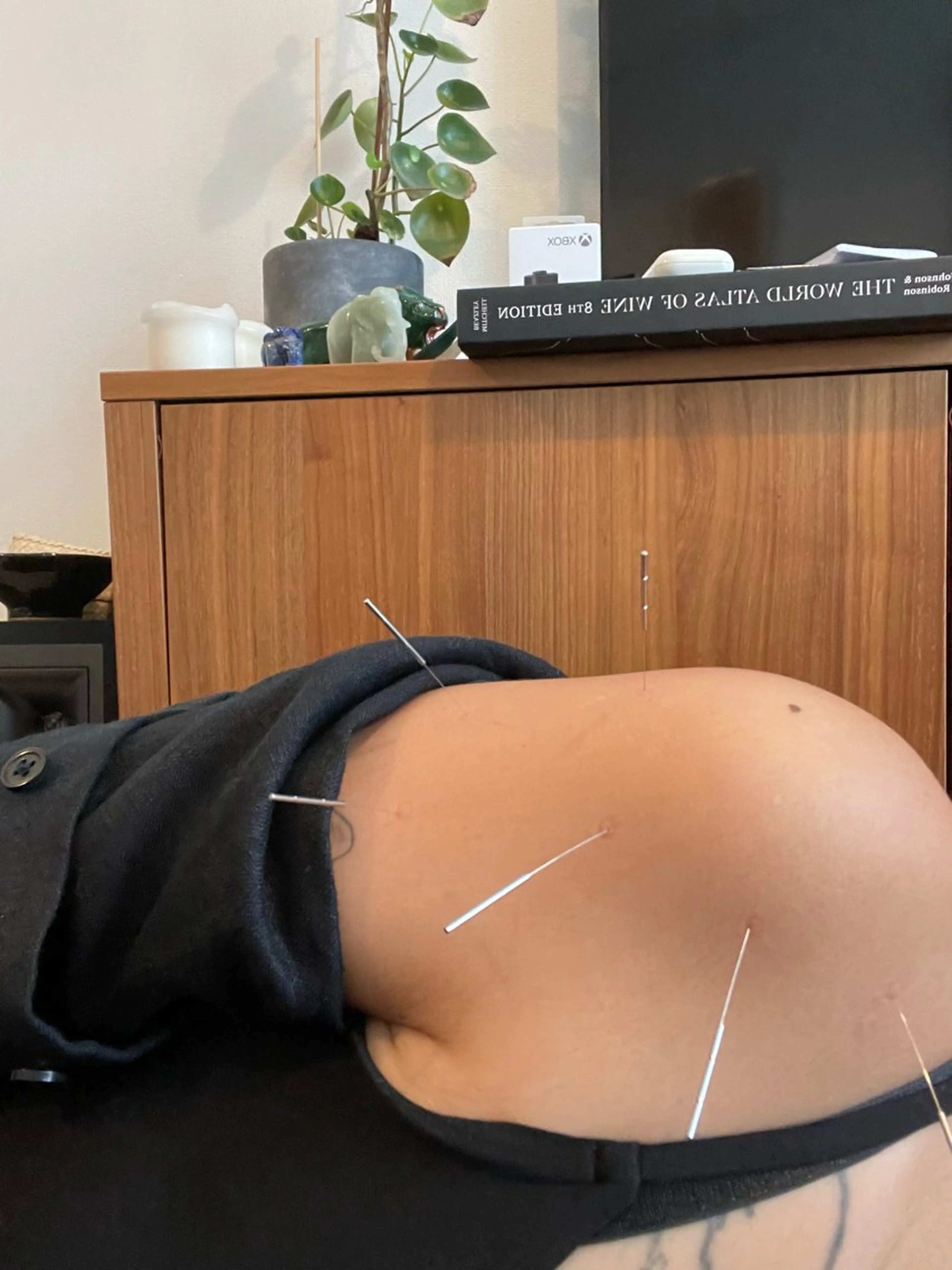 THE  ROOTS所属・美容鍼♡小顔矯正♡ fumikaのエステ・リラクイメージ