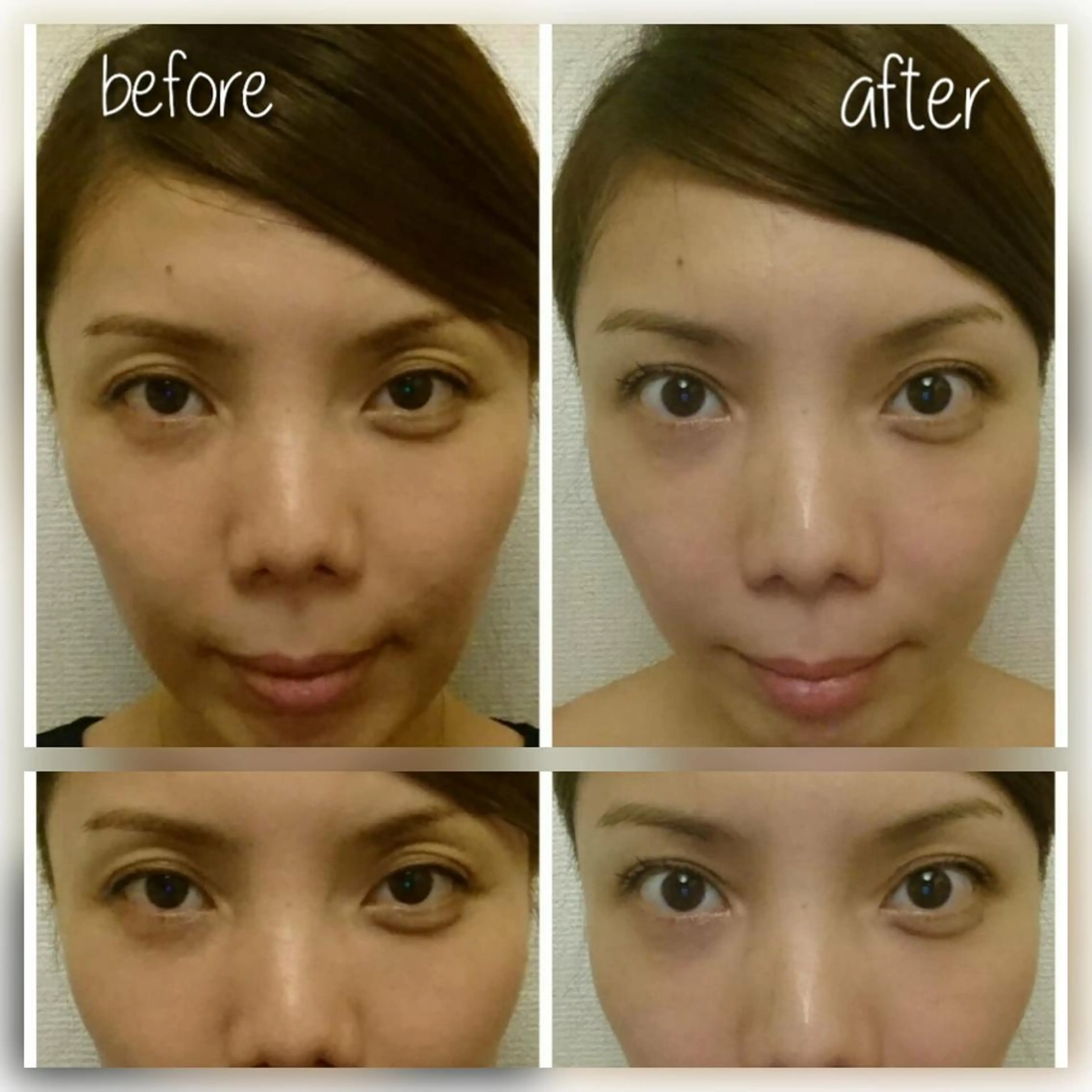 ミディアム ヘアアレンジ マツエク・マツパ エステ リラク 小顔矯正・美容鍼 美鍼堂のエステ・リラクイメージ