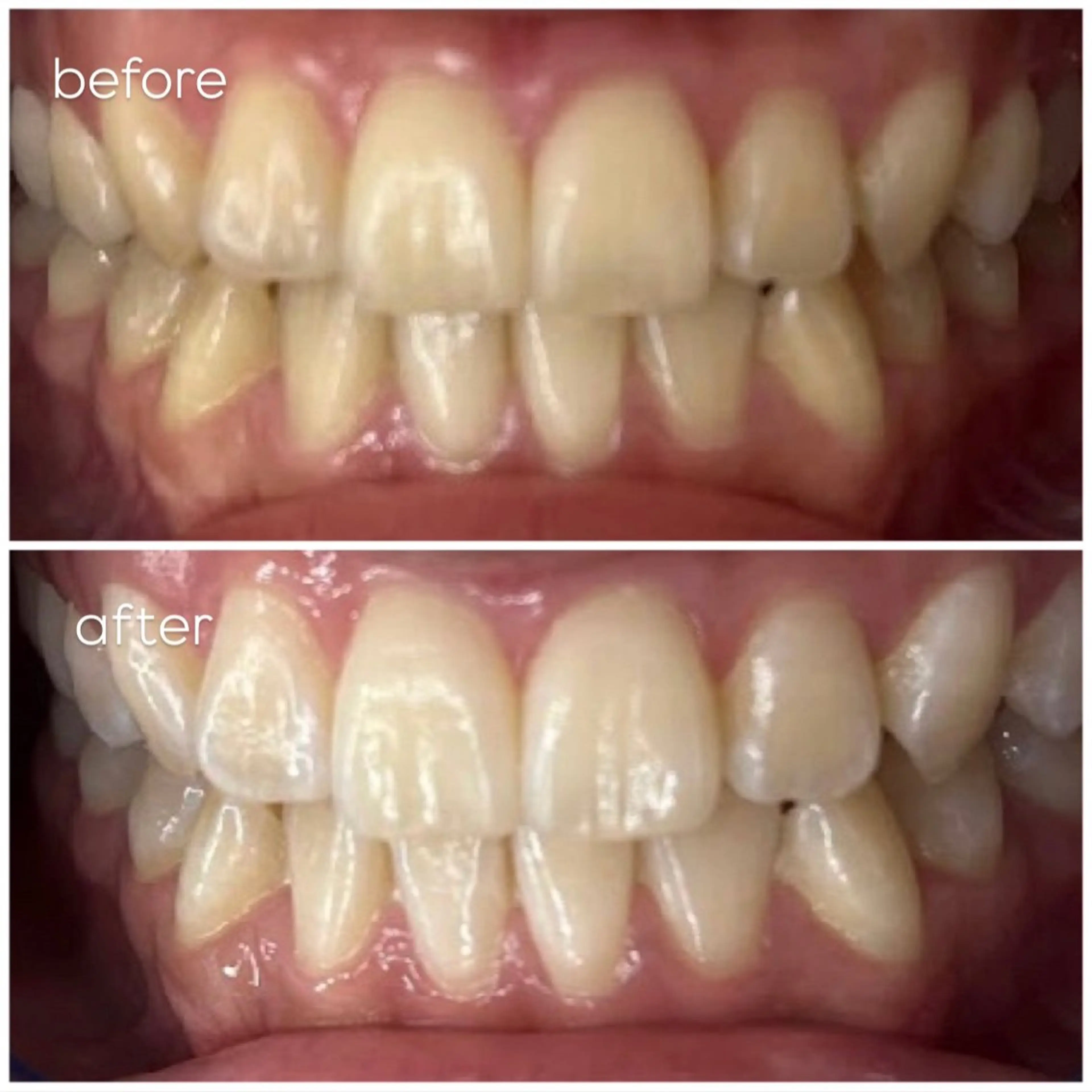 エクシア津駅前店所属・セルフホワイトニング エクシア津駅前店のその他イメージ