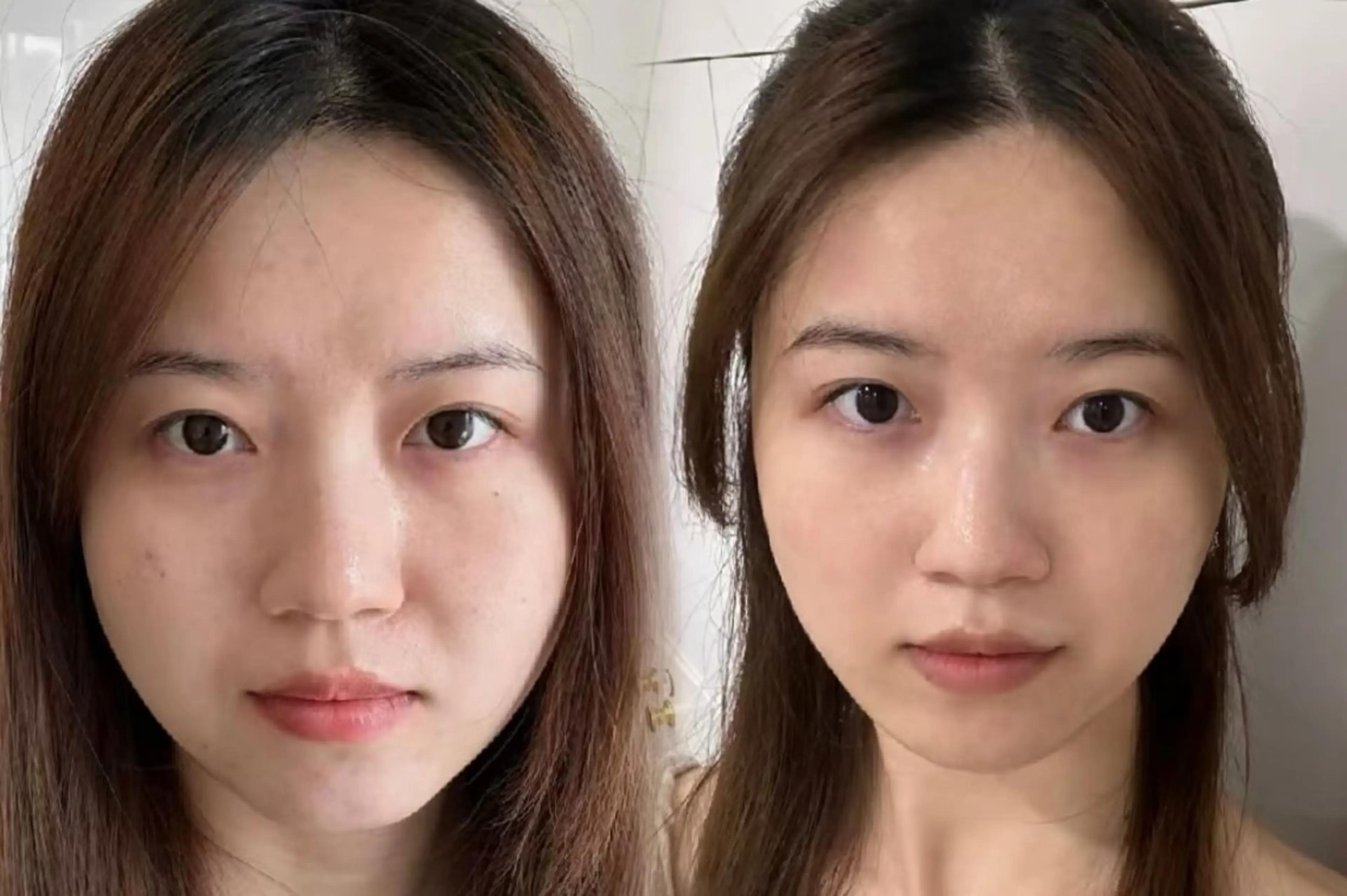 その他 aliaハイフ&水光ジェットサロン所属・aliaハーブ水光店 エステティシャン募集のエステ・リラクイメージ