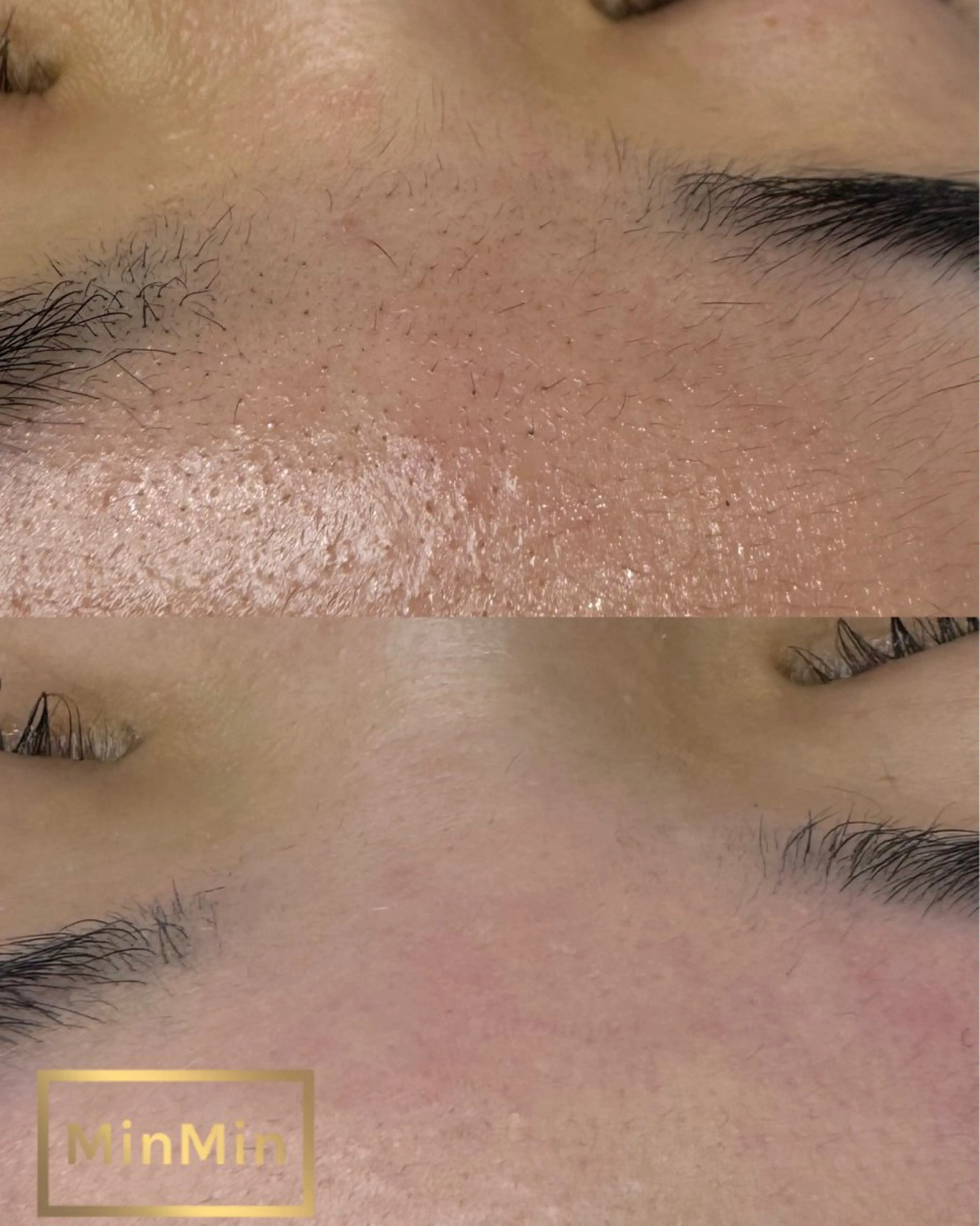 アイブロウ 眉毛ワックス脱毛 ワックス脱毛 Aime'e所属・野田 美早のマツエク・マツパデザイン