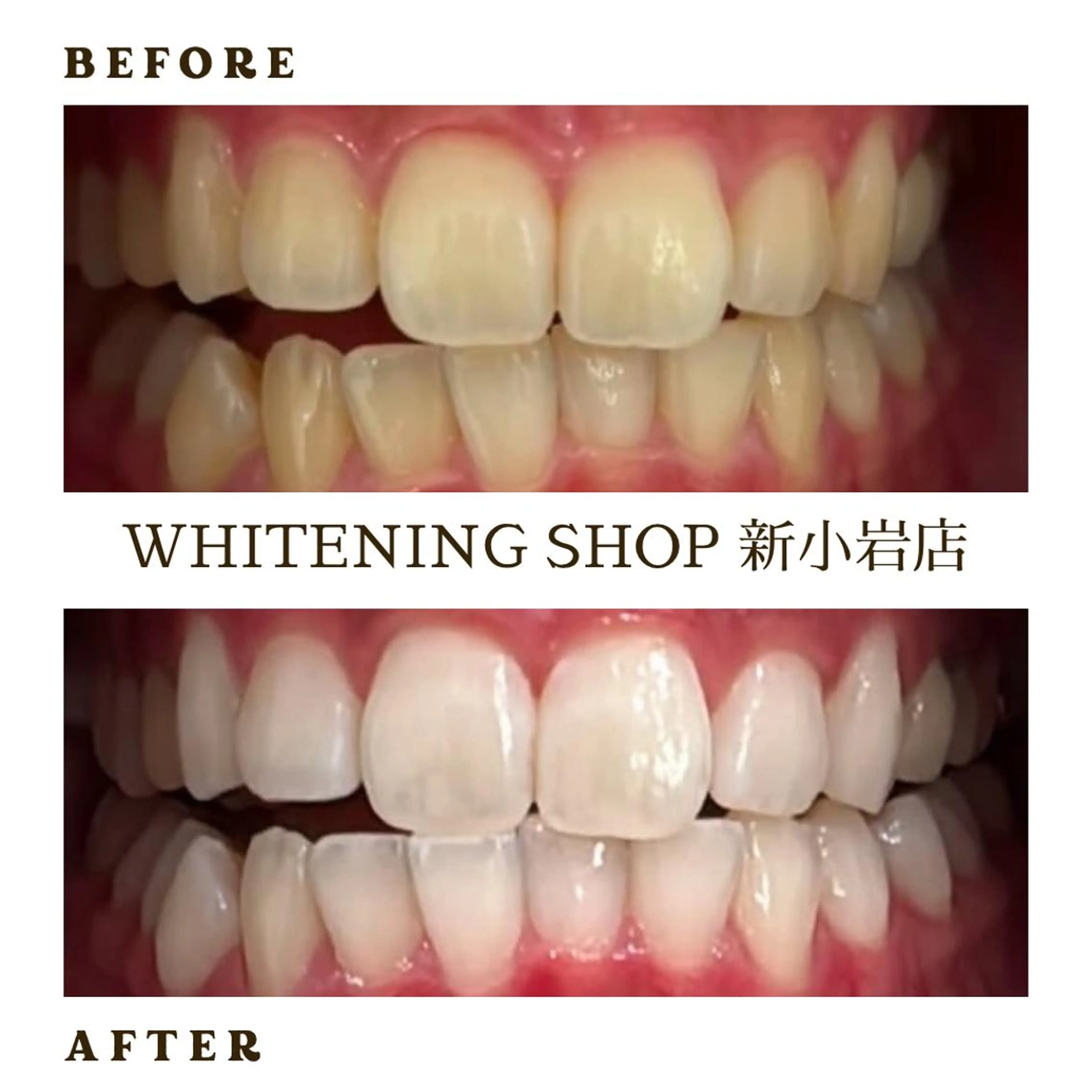 メンズ その他 ホワイトニング ショップ新小岩店のその他イメージ