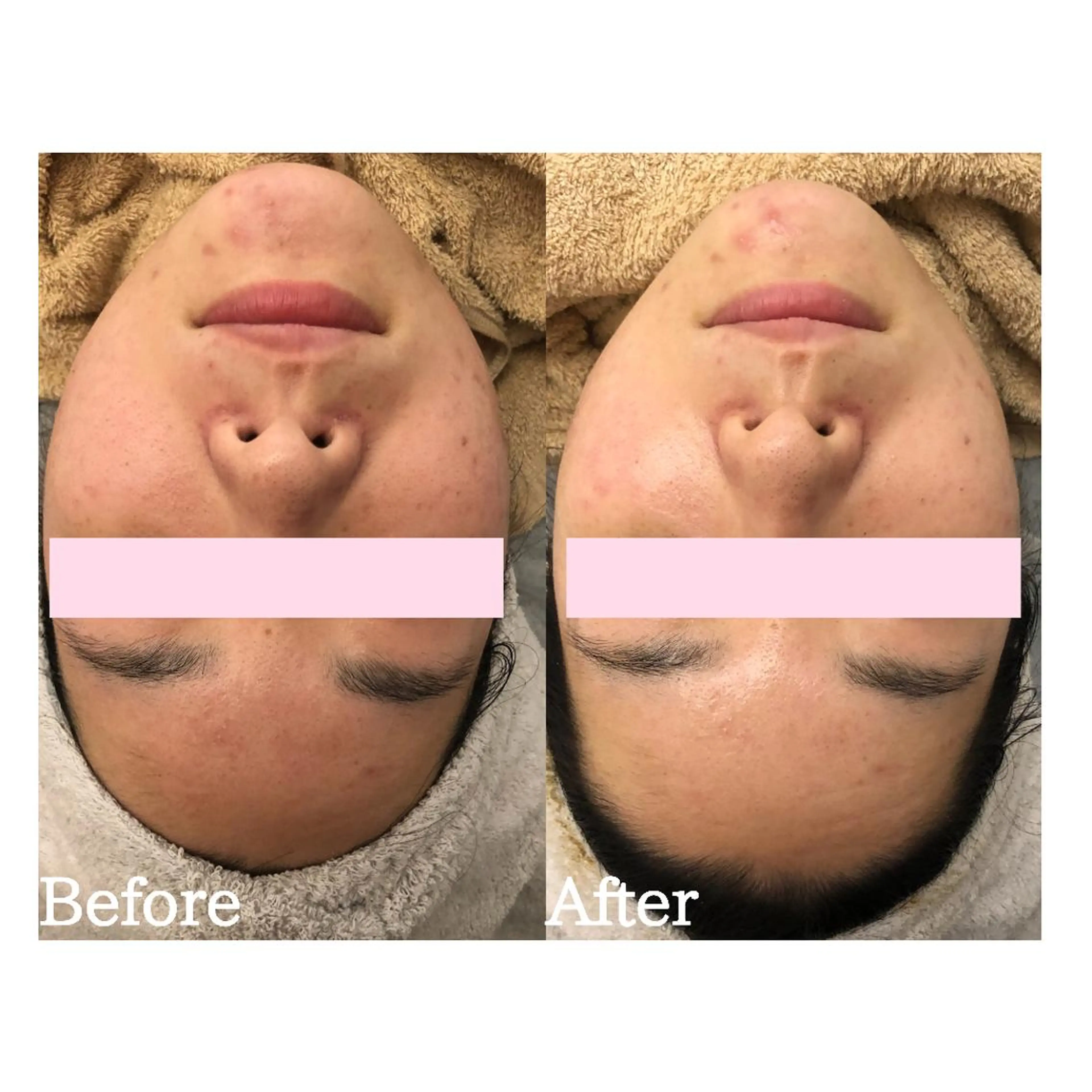 BestBelleꕤ 大阪福島/肌質改善のエステ・リラクイメージ