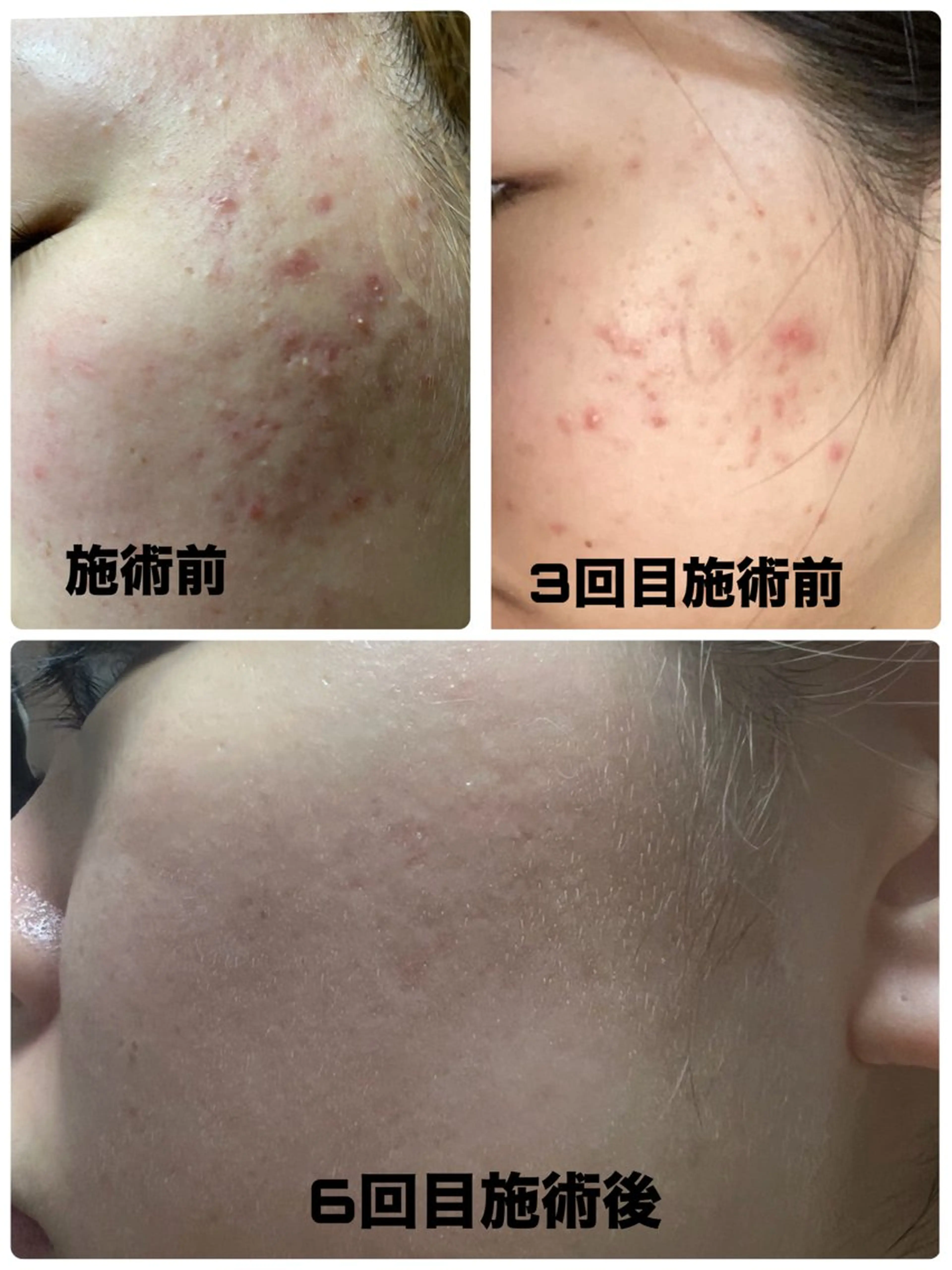 スリーエスプラス内　美肌サロンEme所属・希映 -kieのエステ・リラクイメージ