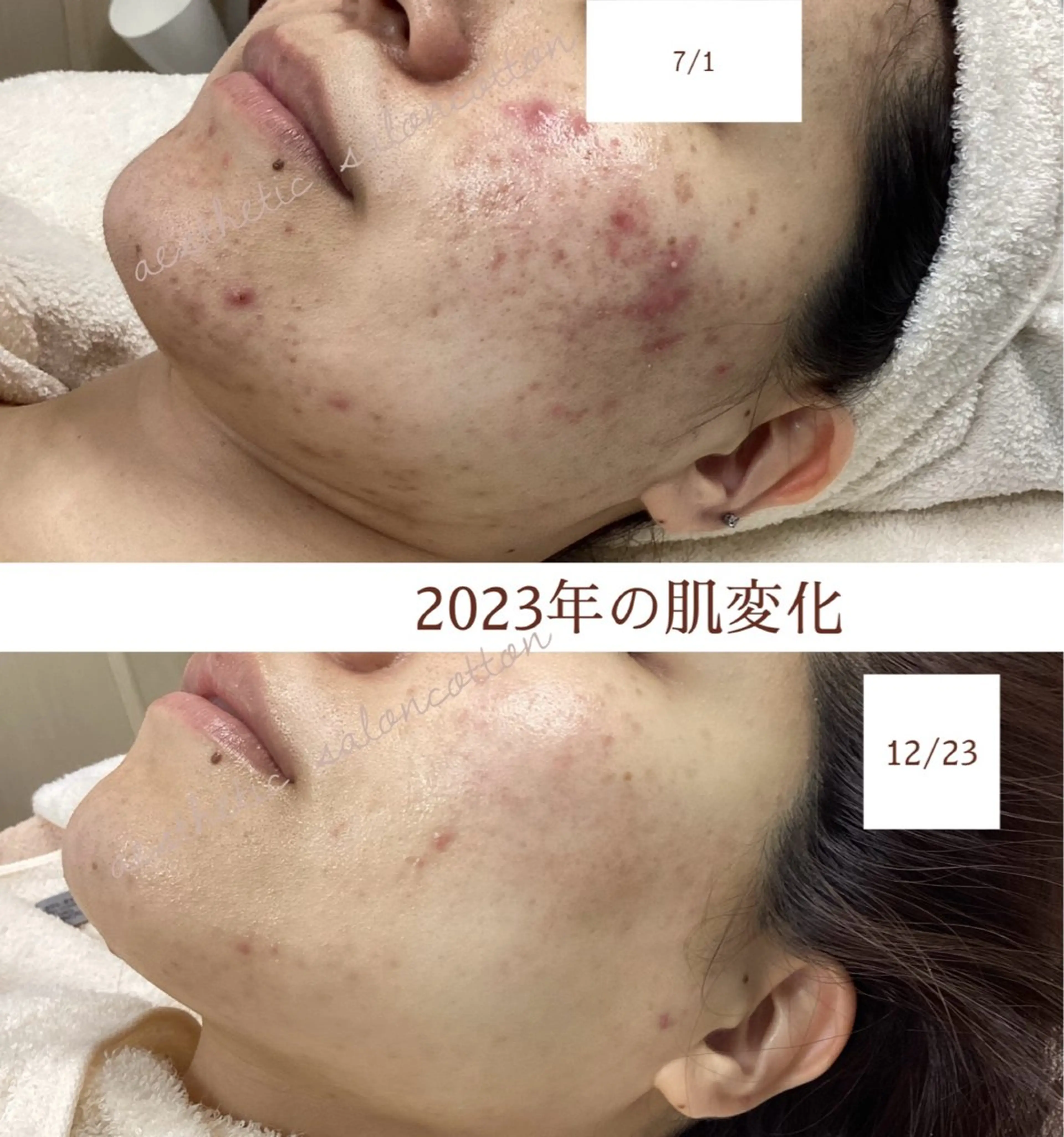 エステ 都度払い 肌質改善専門サロンのエステ・リラクイメージ