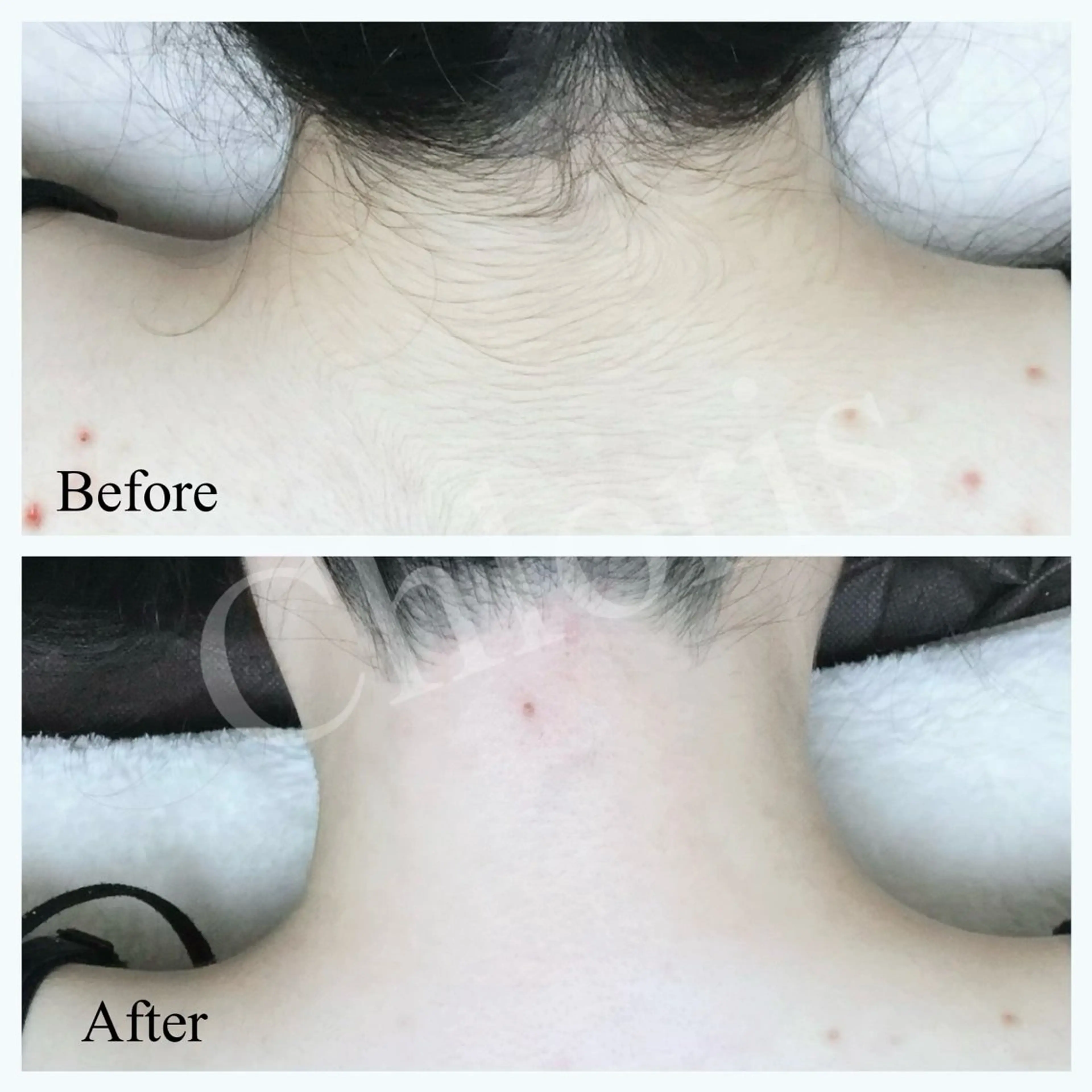 川越ローマピンク 光脱毛＆ワックス脱毛のエステ・リラクイメージ