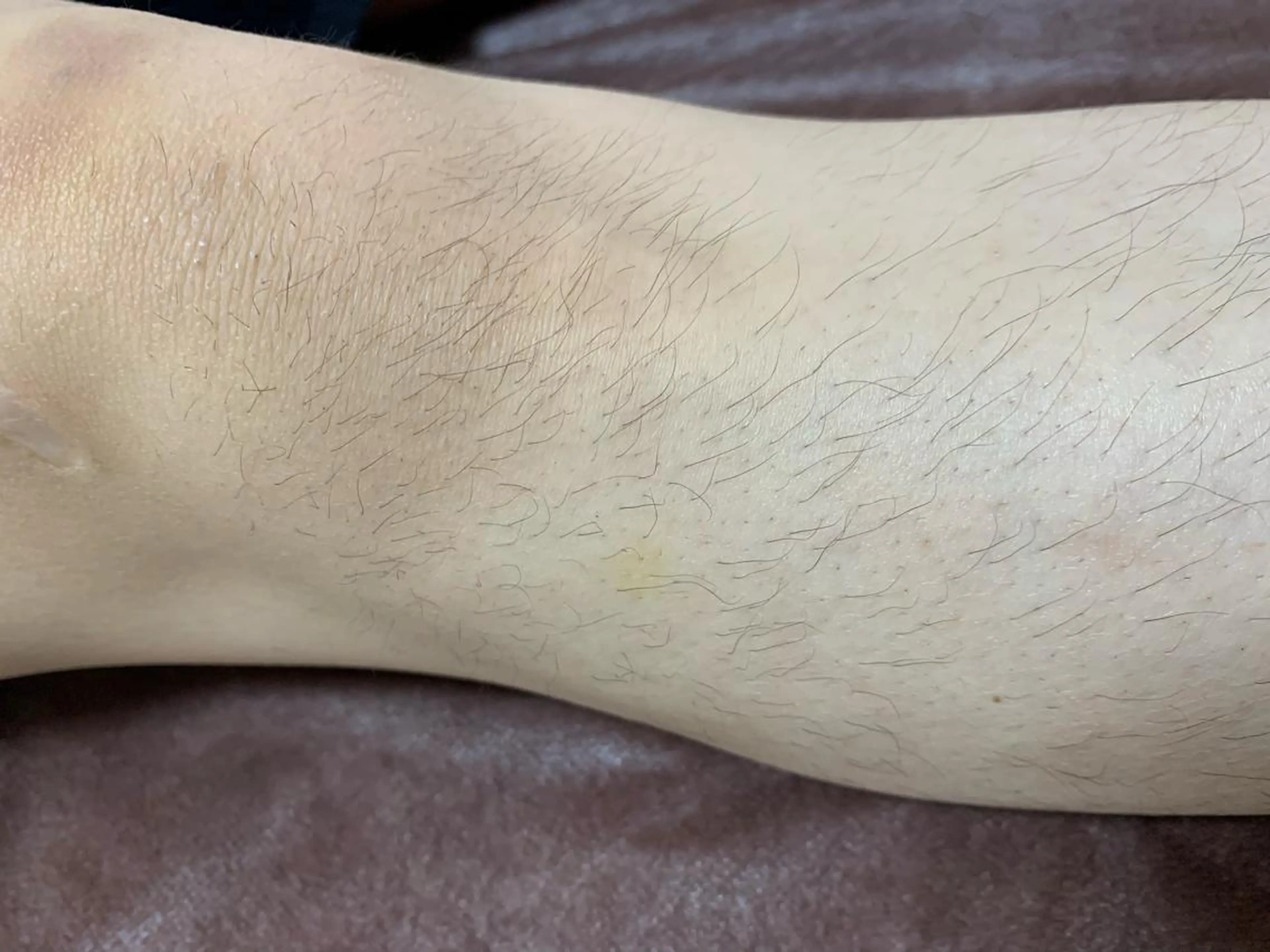 メンズ キッズ 脱毛SALON RaYNiCKのエステ・リラクイメージ