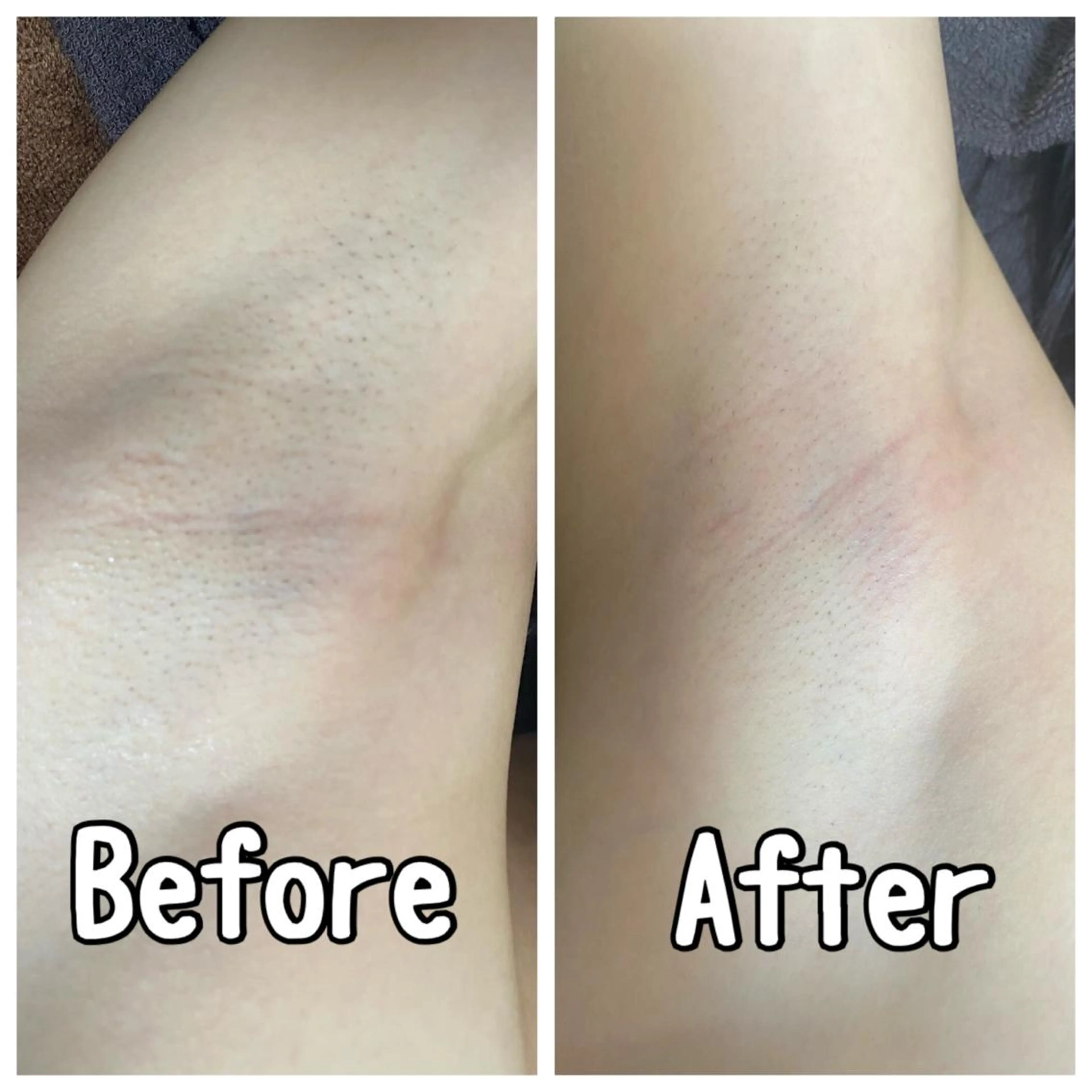 脱毛 都度払い制脱毛サロンBe Charm所属・Be Charm 山﨑のエステ・リラクイメージ