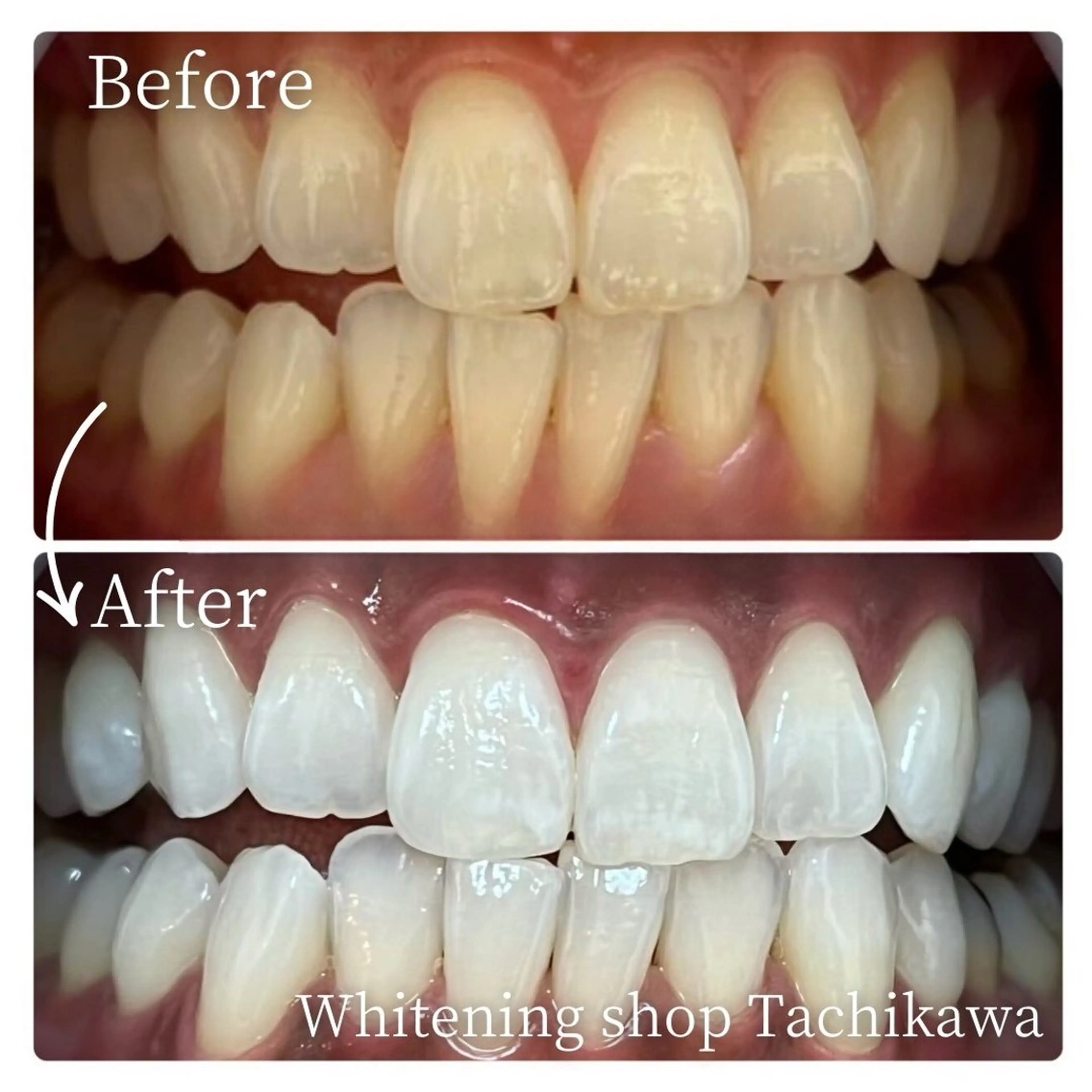 セルフ ホワイト ニングショップ立川のその他イメージ