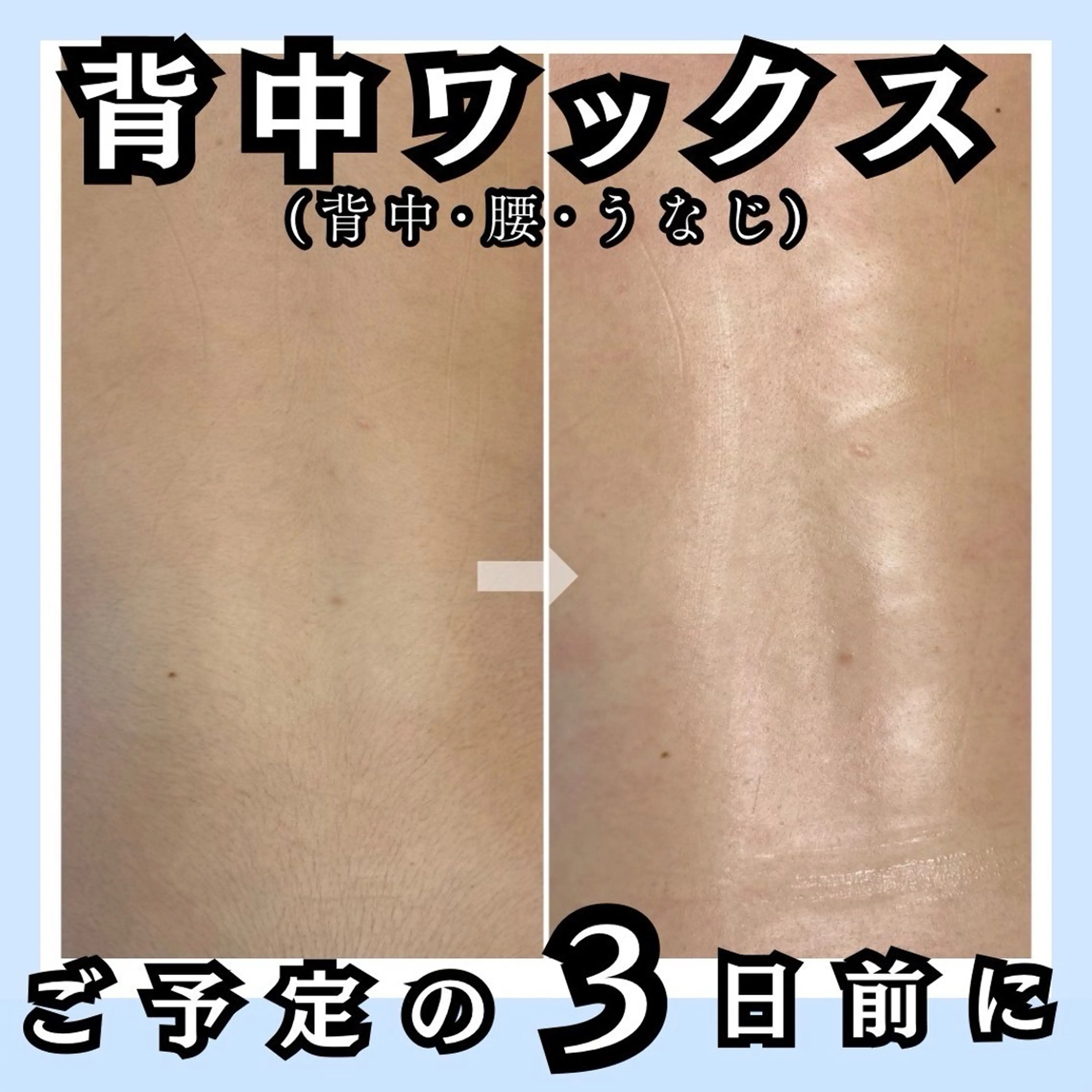 脱毛 毛穴レス ハーブ& ワックス脱毛×光脱毛のエステ・リラクイメージ