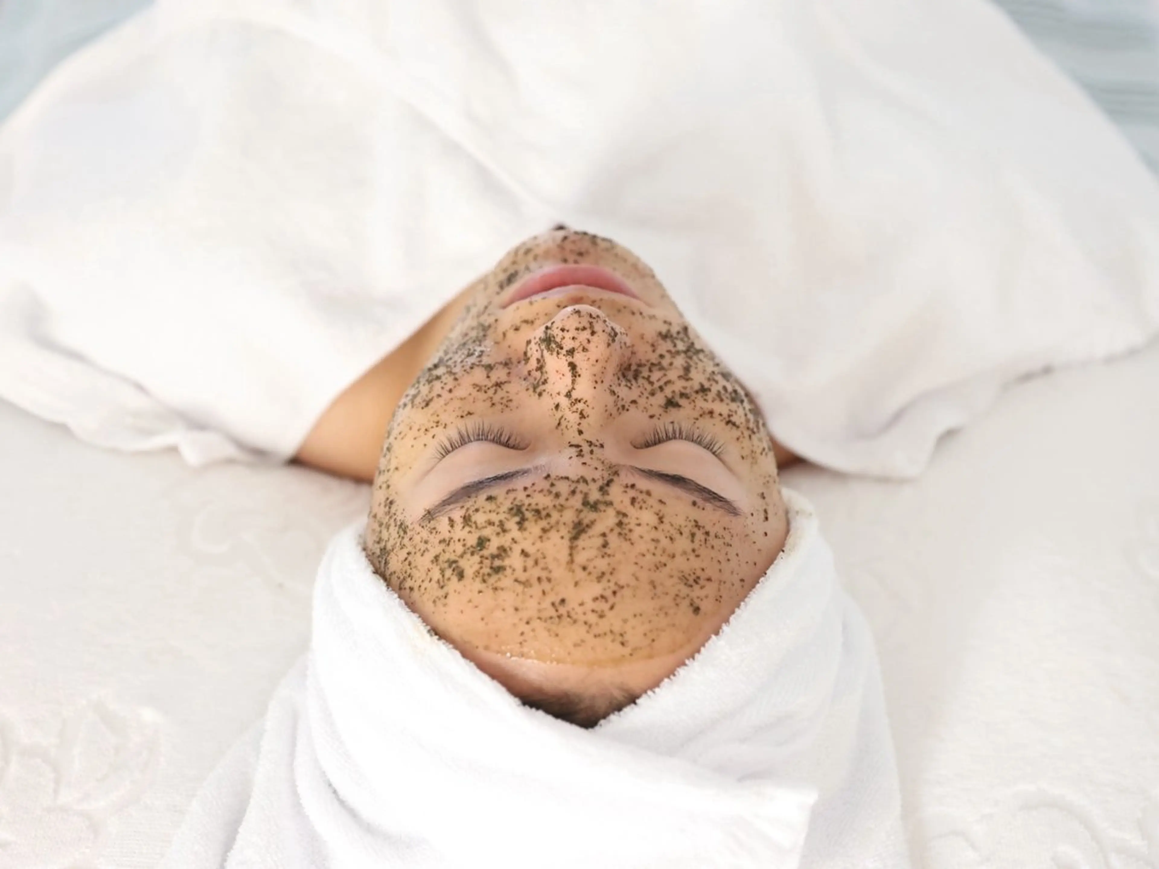 3周年記念期間限定30%OFFクリスティーナ【ローズドメーラ】全顔です⭐︎剥離&ダウンタイム5〜7日程有り!個人差ありの写真