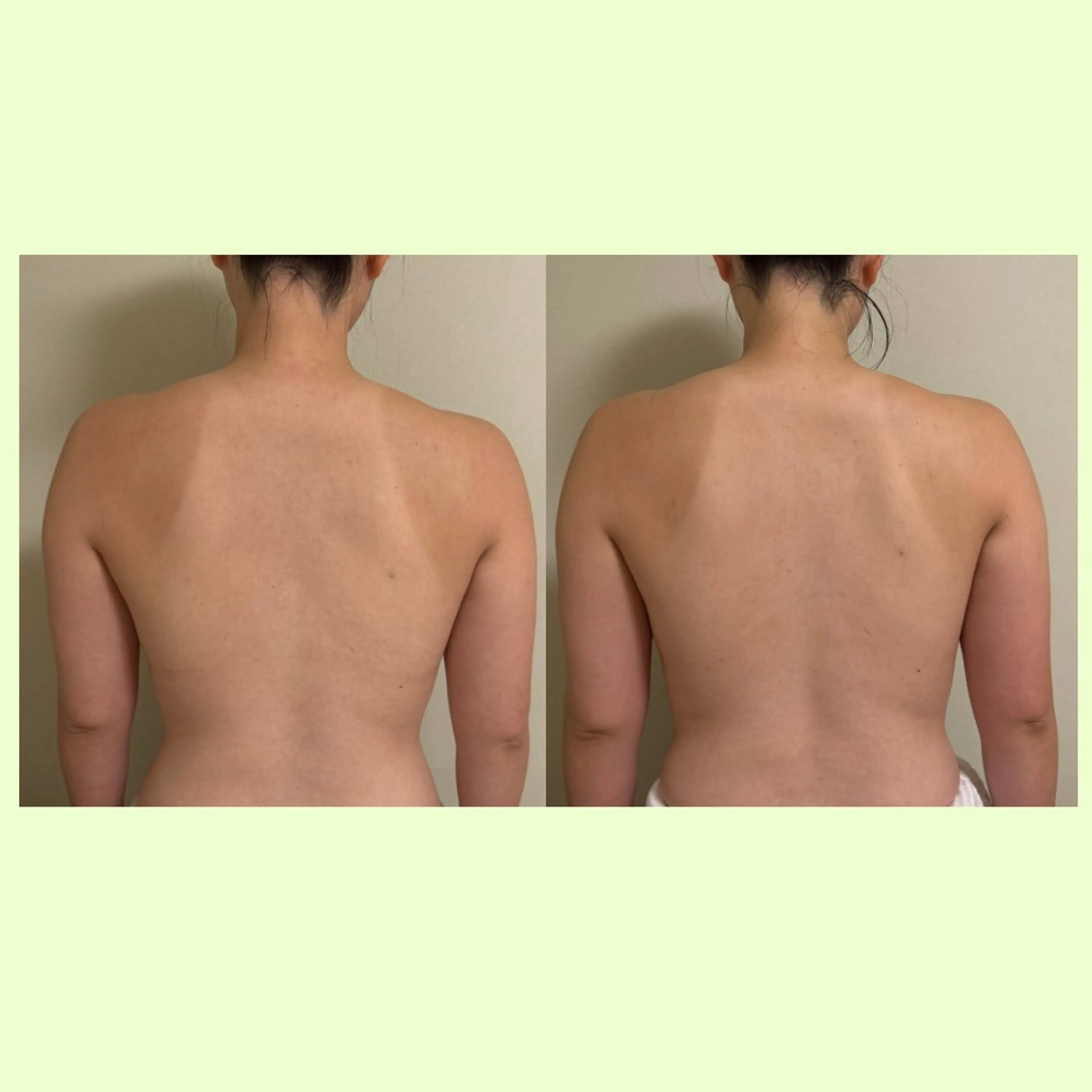 リラクゼーションスパ　ひのき所属・spaHINOKI 【女性専用】のエステ・リラクイメージ