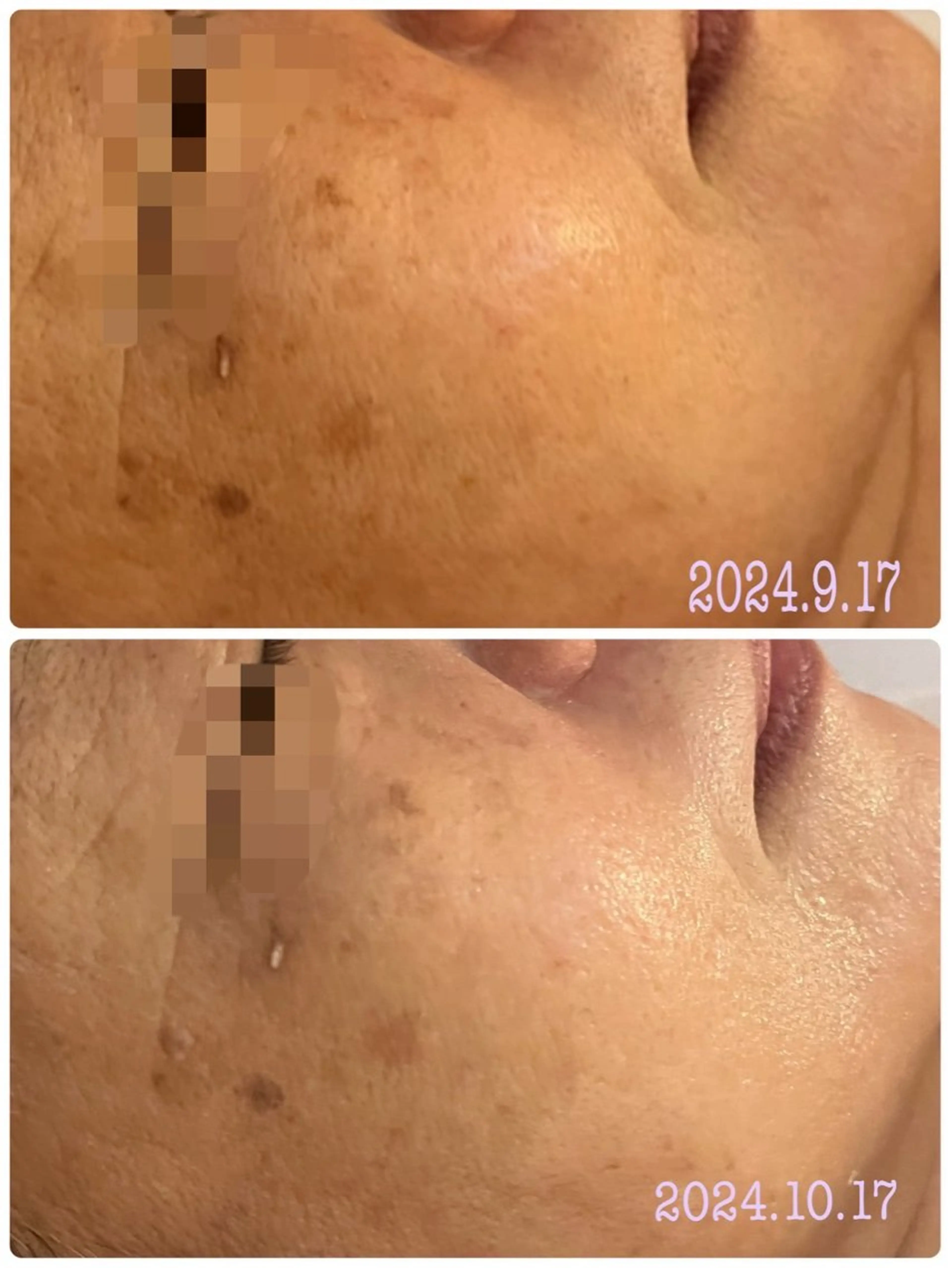 エステ 武藤 千裕のエステ・リラクイメージ