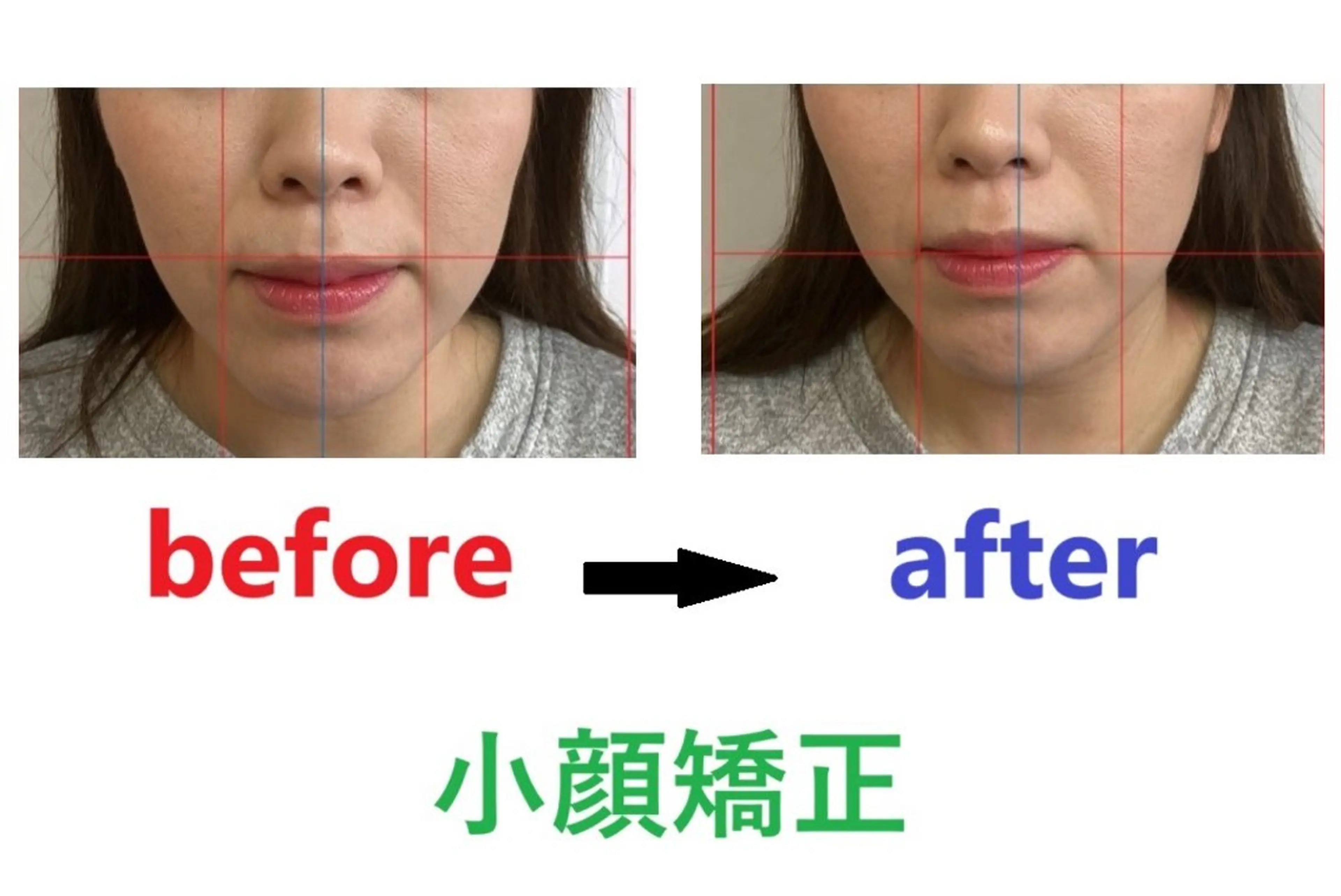 豊津BM整骨院所属・木田 明訓のエステ・リラクイメージ