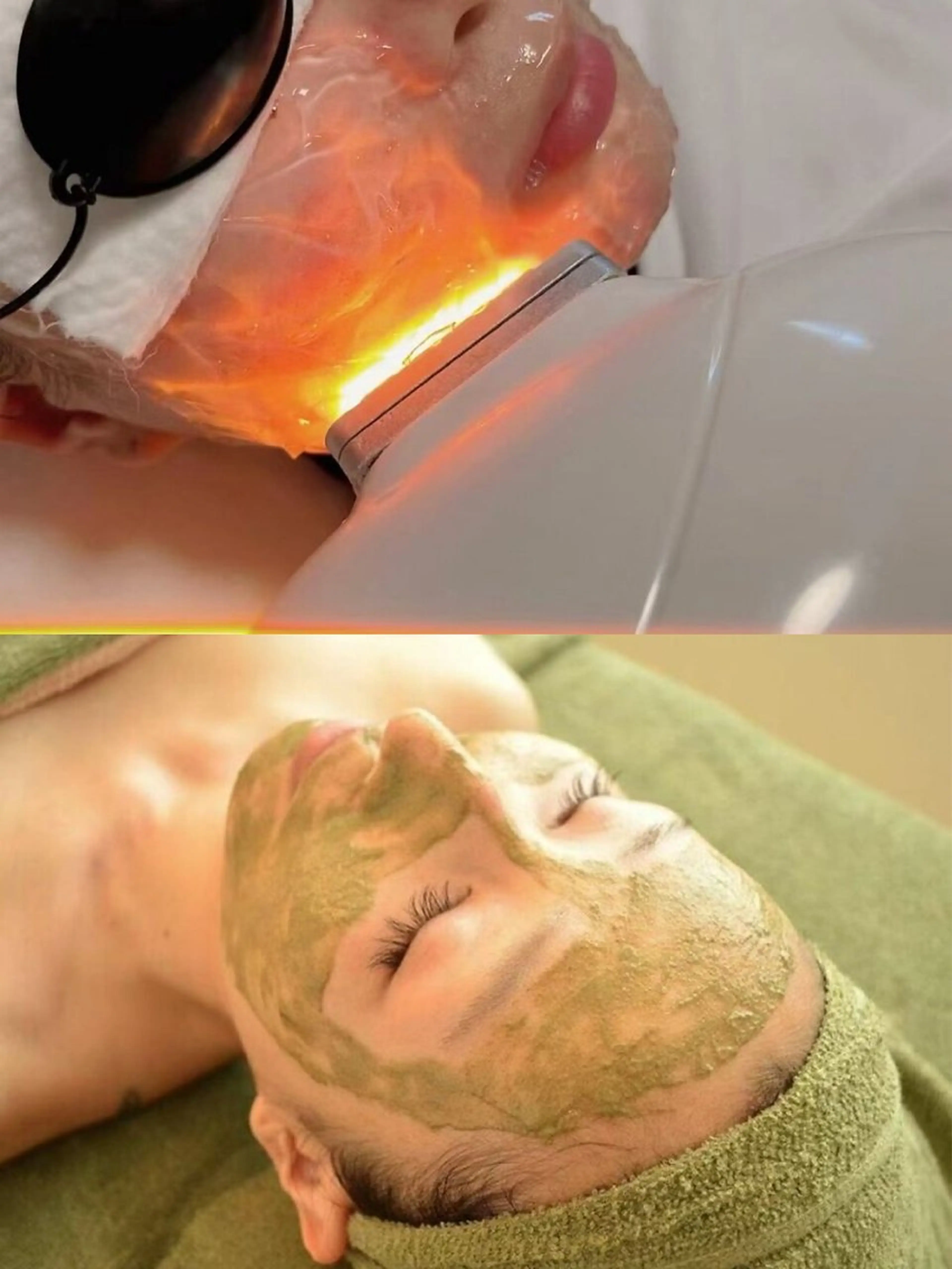 根本改善コース/毛穴洗浄&光フェイシャル&ハーブピーリングの写真