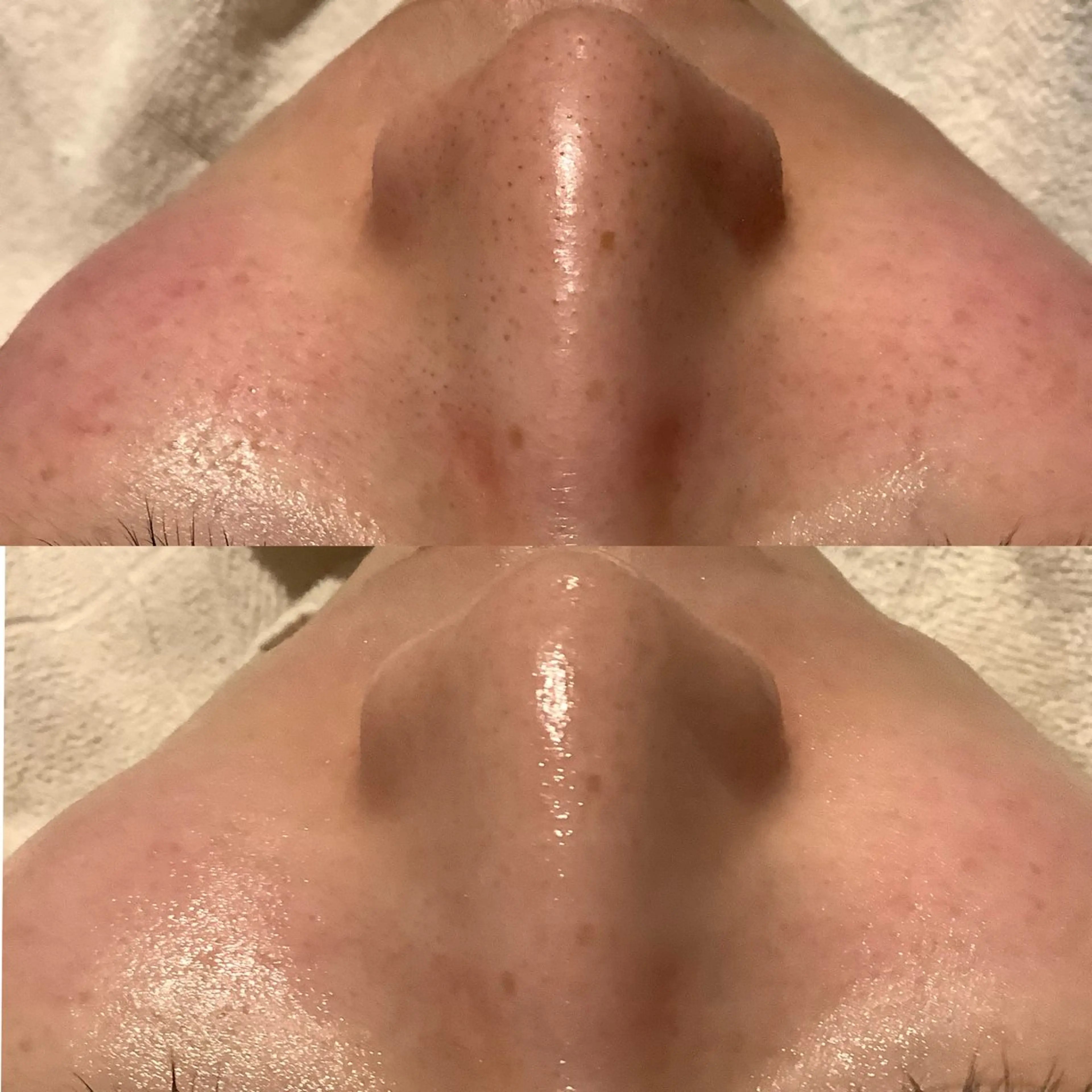 エステ 脱毛&エステサロン JIGGLY武蔵小山のエステ・リラクイメージ