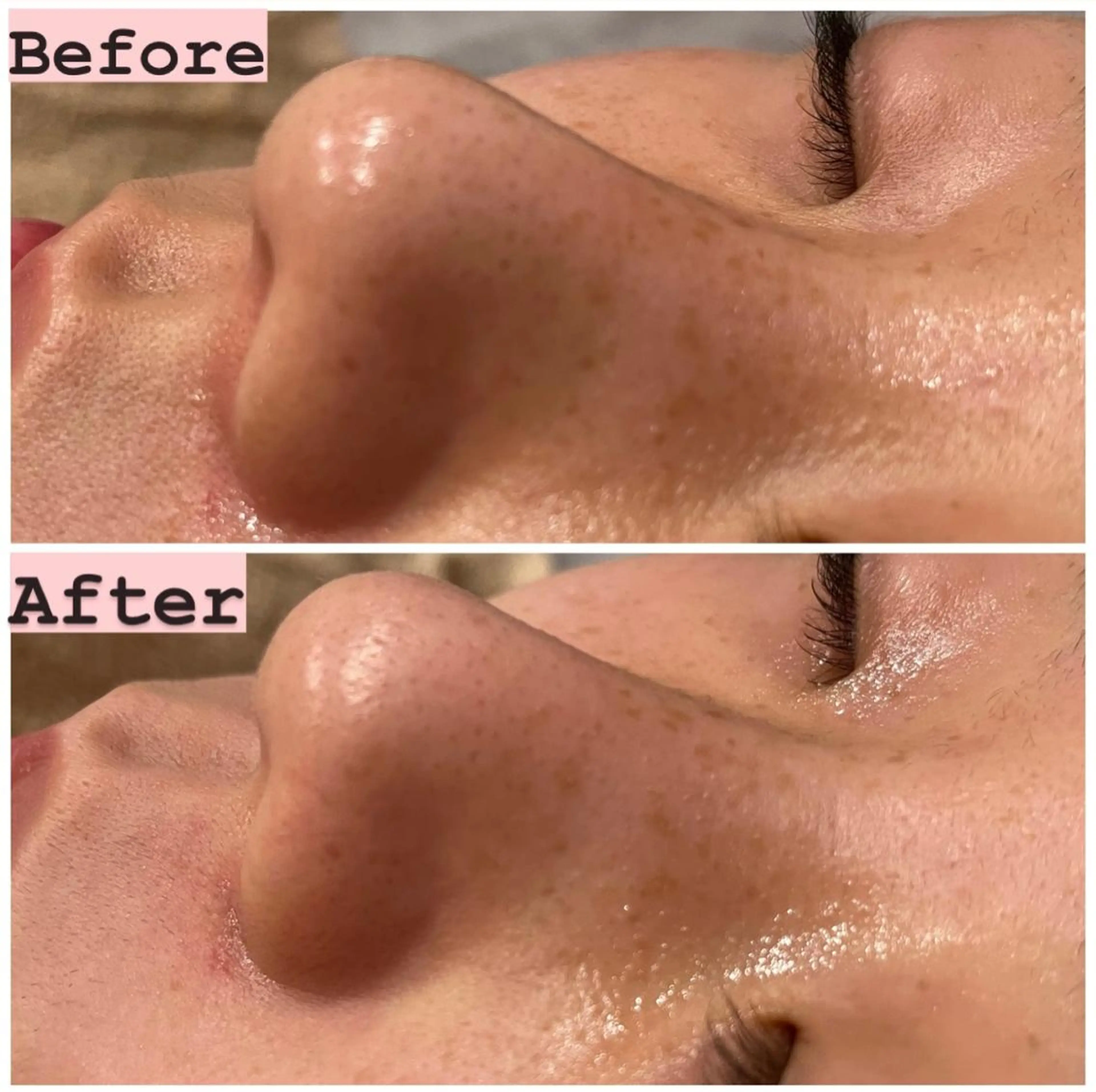 ハーブピーリング専門 muro.のエステ・リラクイメージ