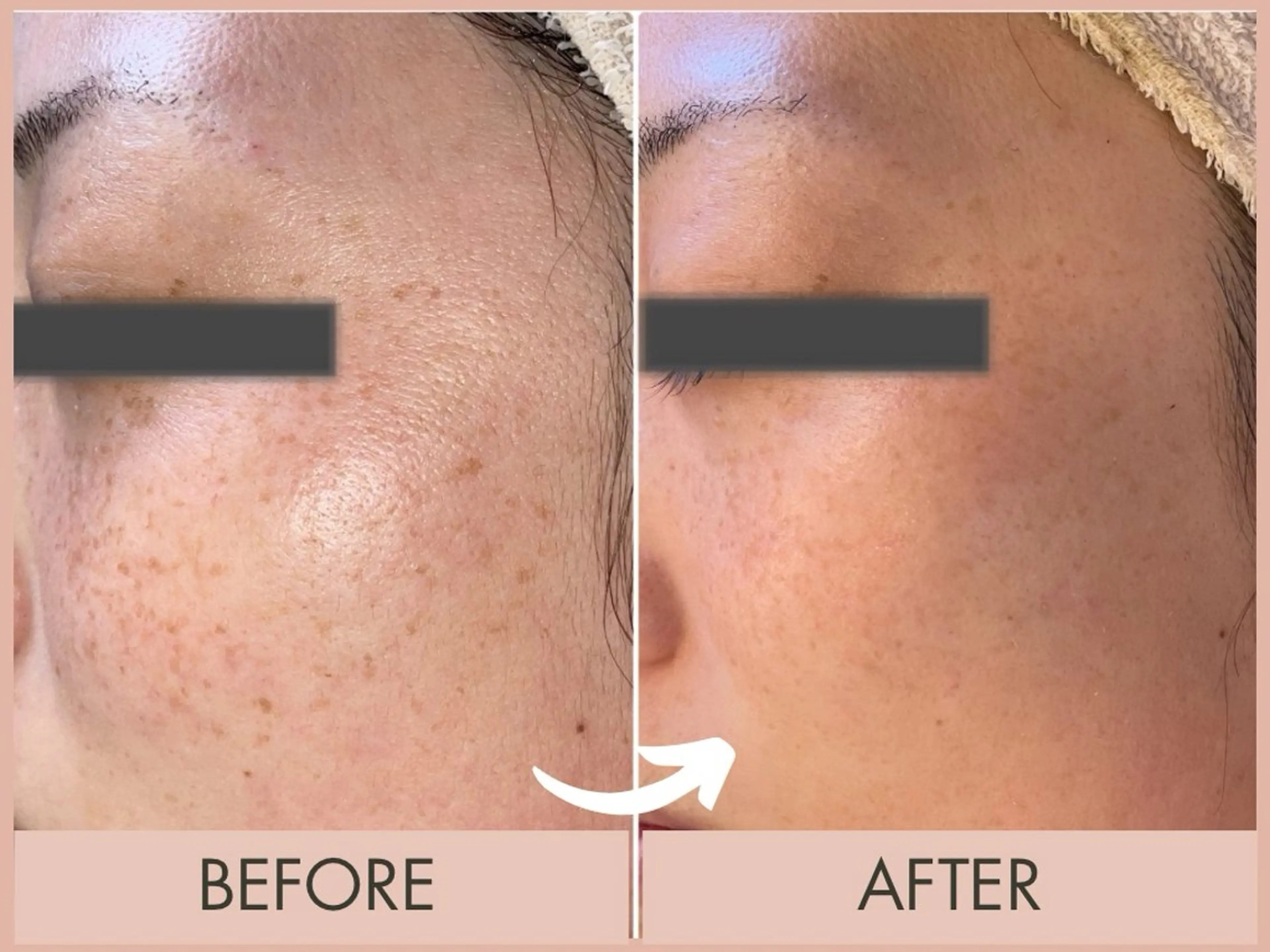 エステ private salon VIALL所属・プライベートサロン VIALLのエステ・リラクイメージ