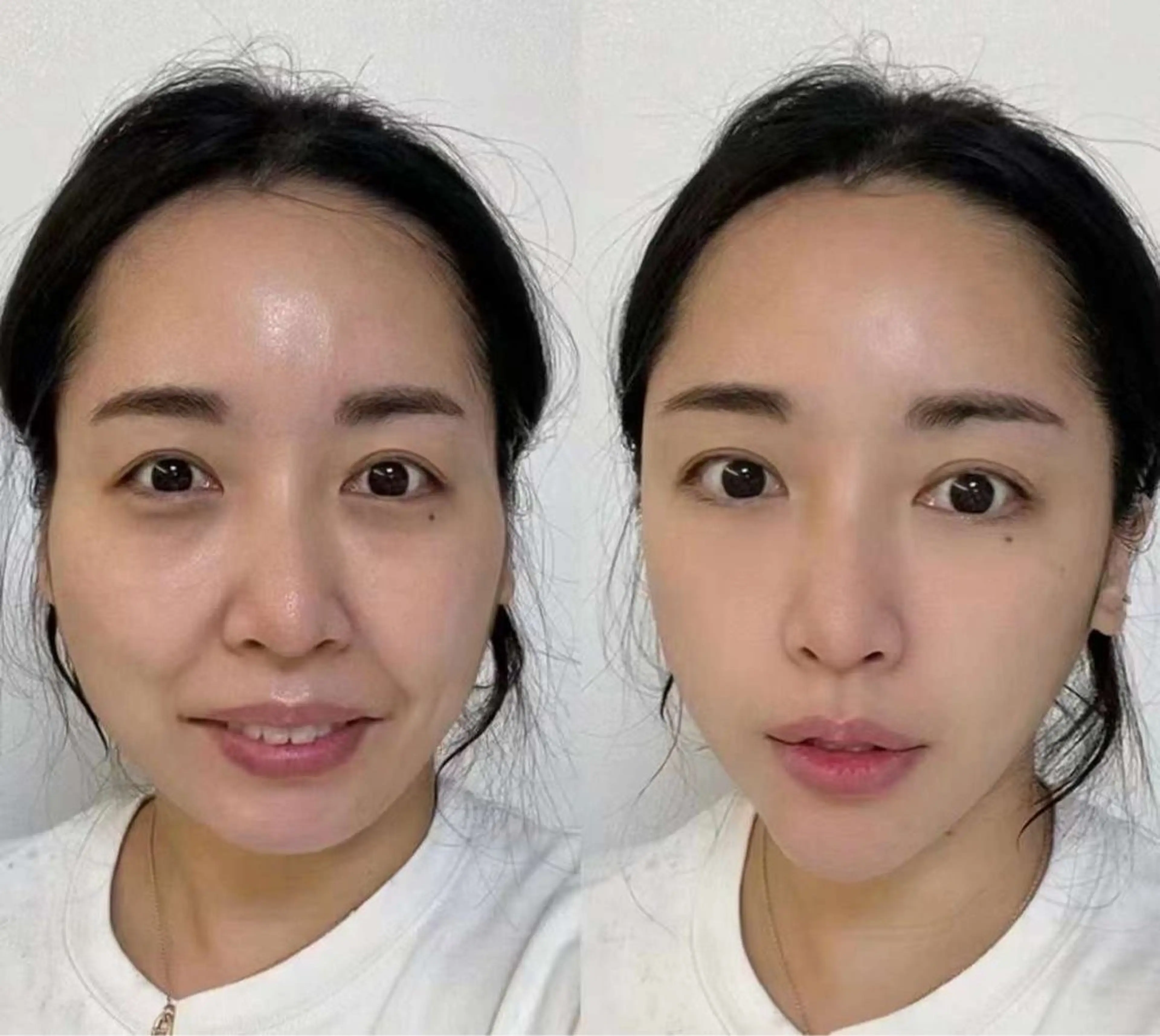 マツエク・マツパ 結婚式・ブライダル エステ aliaハイフ&水光ジェットサロン所属・aliaハーブ水光店 エステティシャン募集のエステ・リラクイメージ