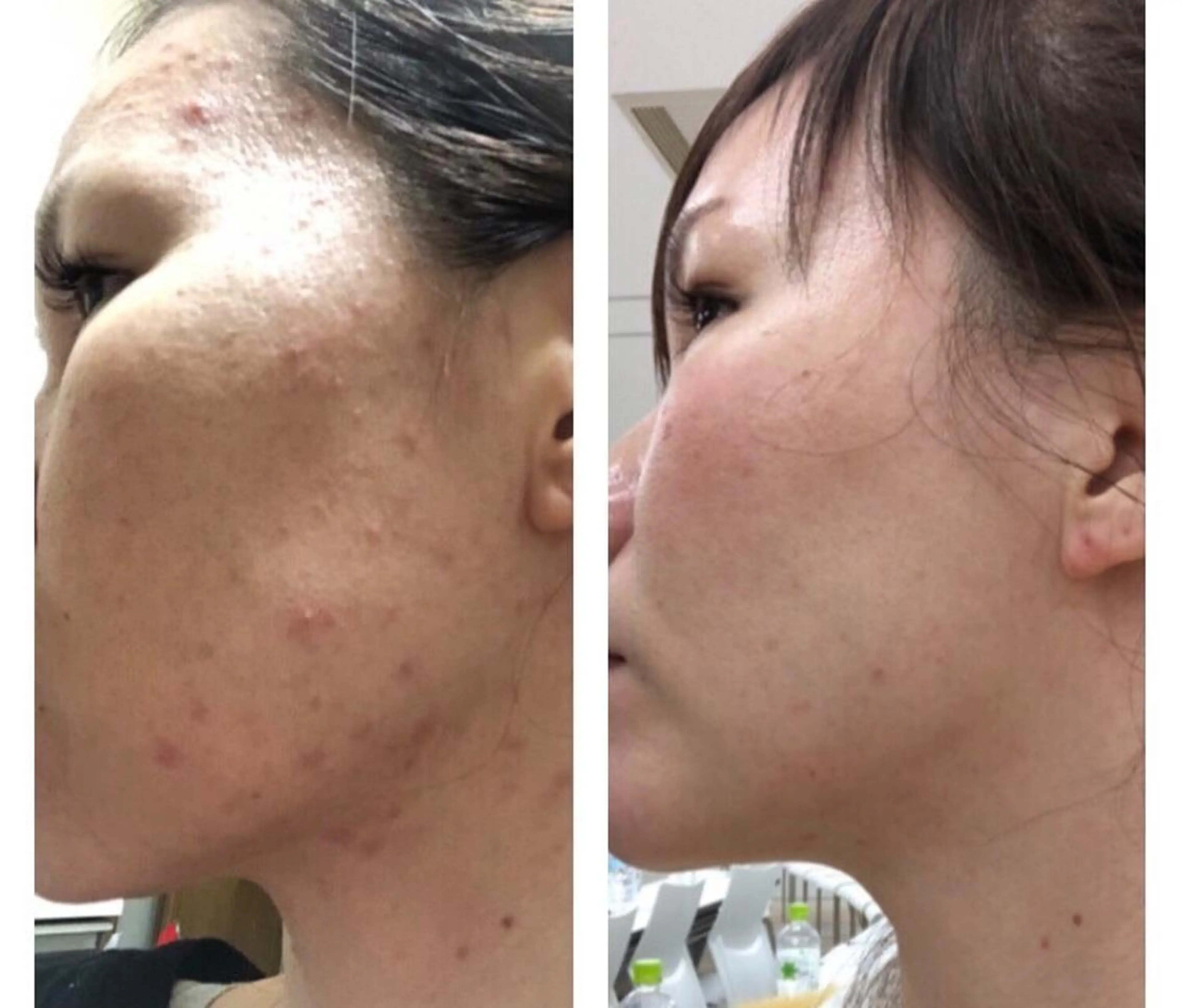 YOSAPARK八王子店所属・YOSAPARK 八王子店のエステ・リラクイメージ