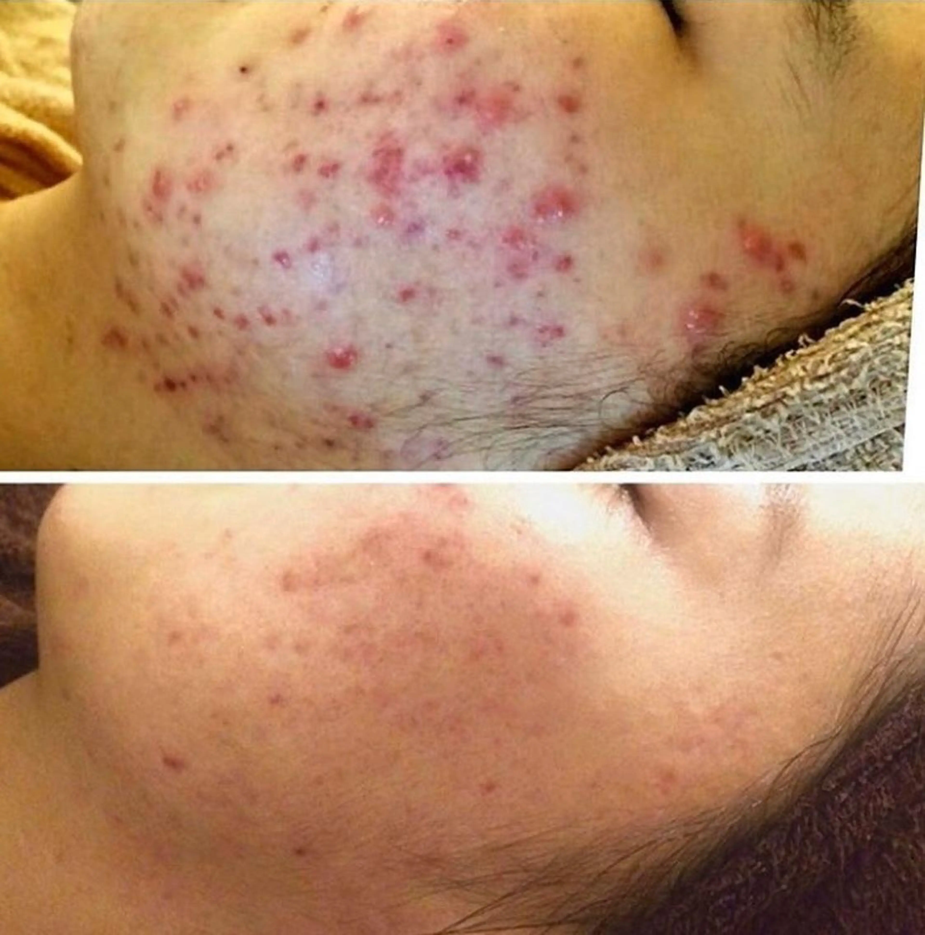 西区九条エステ MITUREIサロンのエステ・リラクイメージ