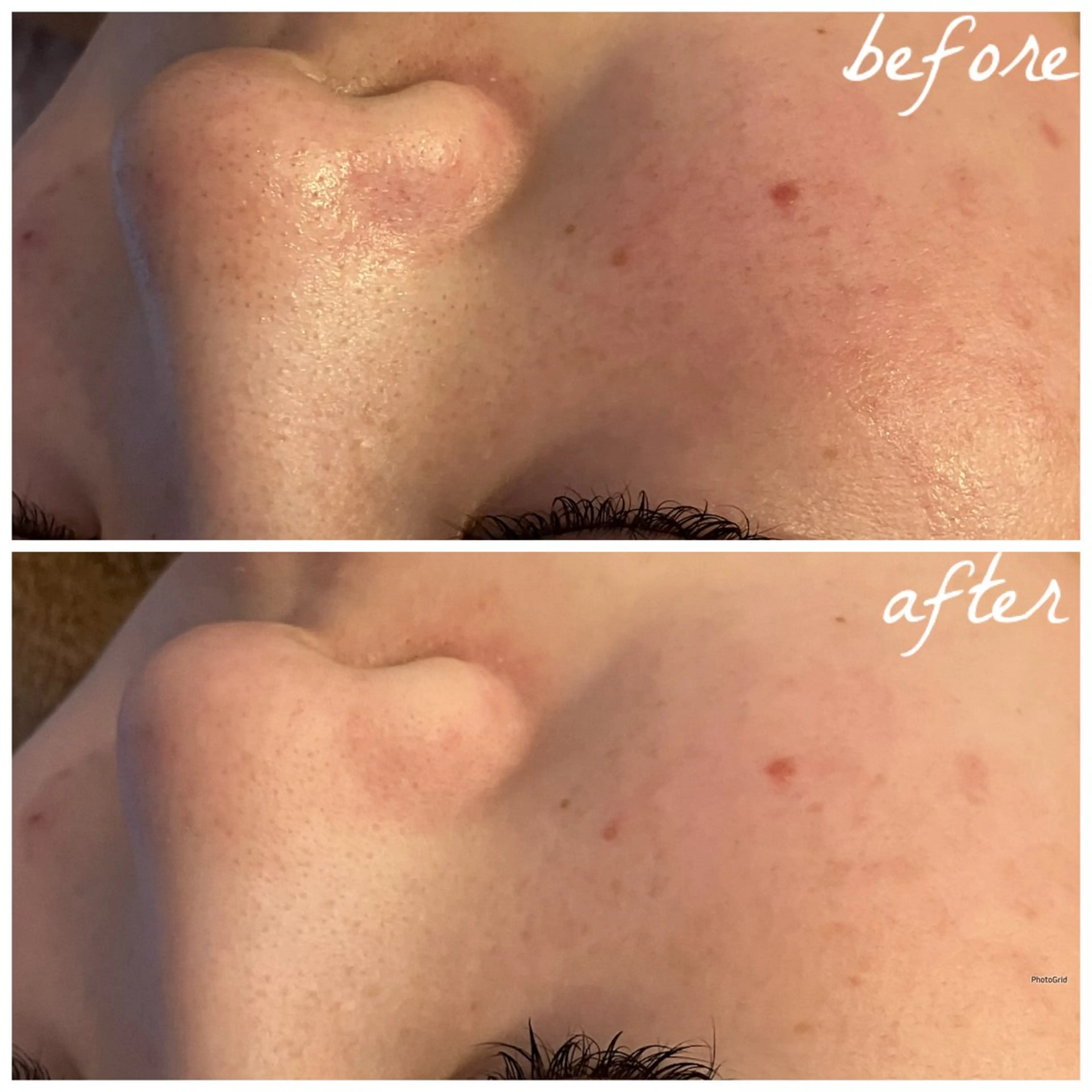 メンズ メナード岐阜茜部 杉浦のエステ・リラクイメージ