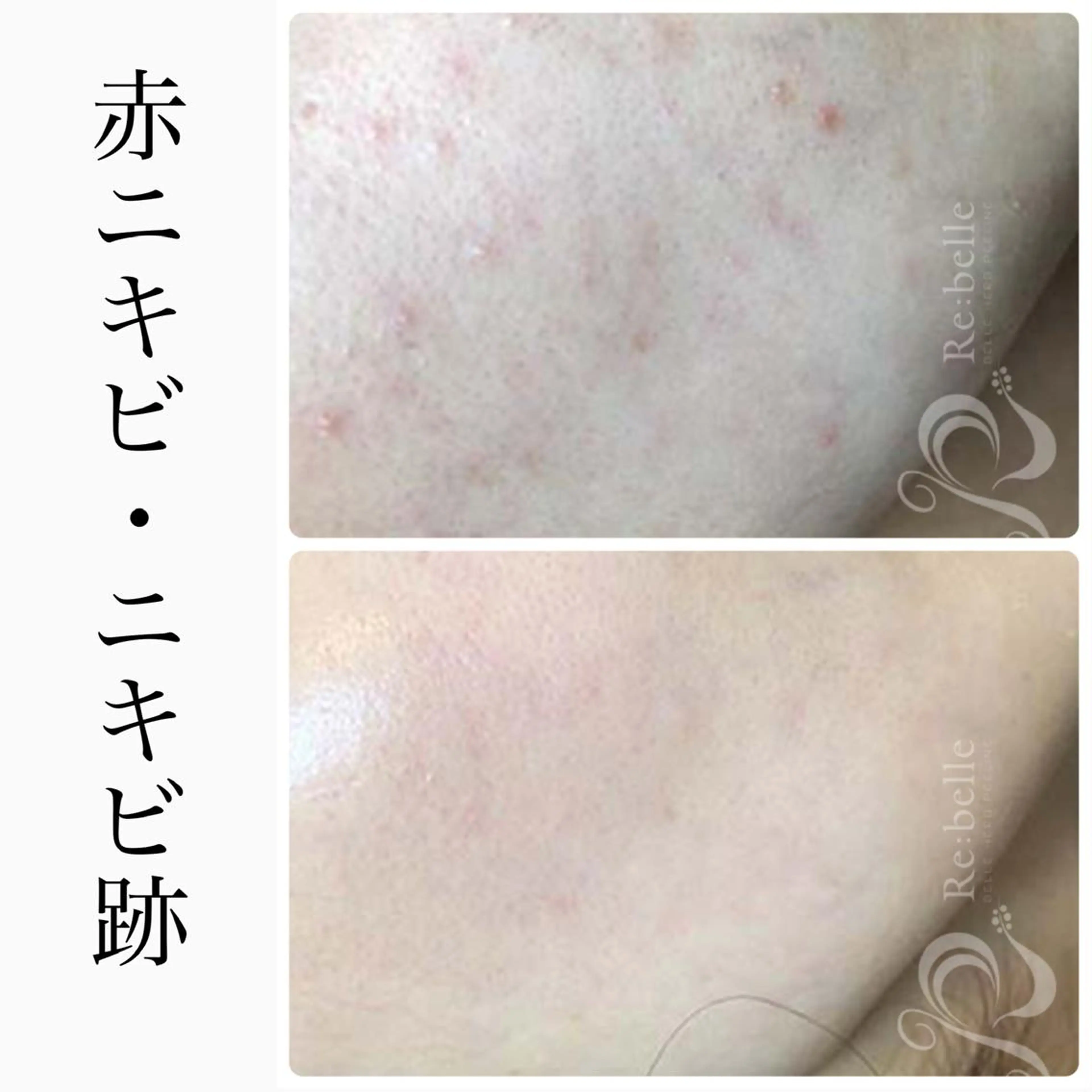 エステ ハーブピーリング専門 BIOEL横浜のエステ・リラクイメージ