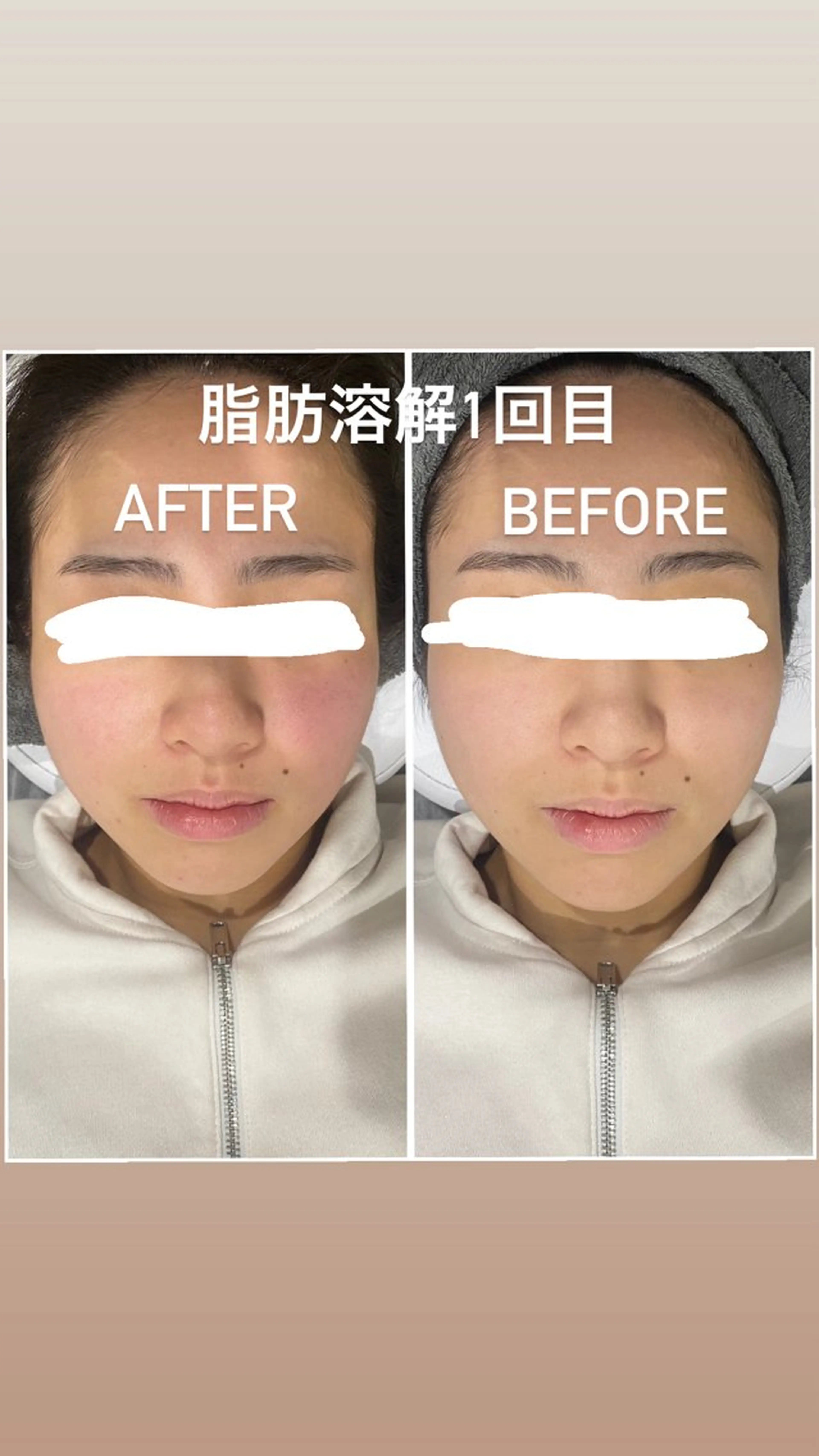 エステ 毛穴洗浄・痩身・脱毛 /アルカンジュのエステ・リラクイメージ