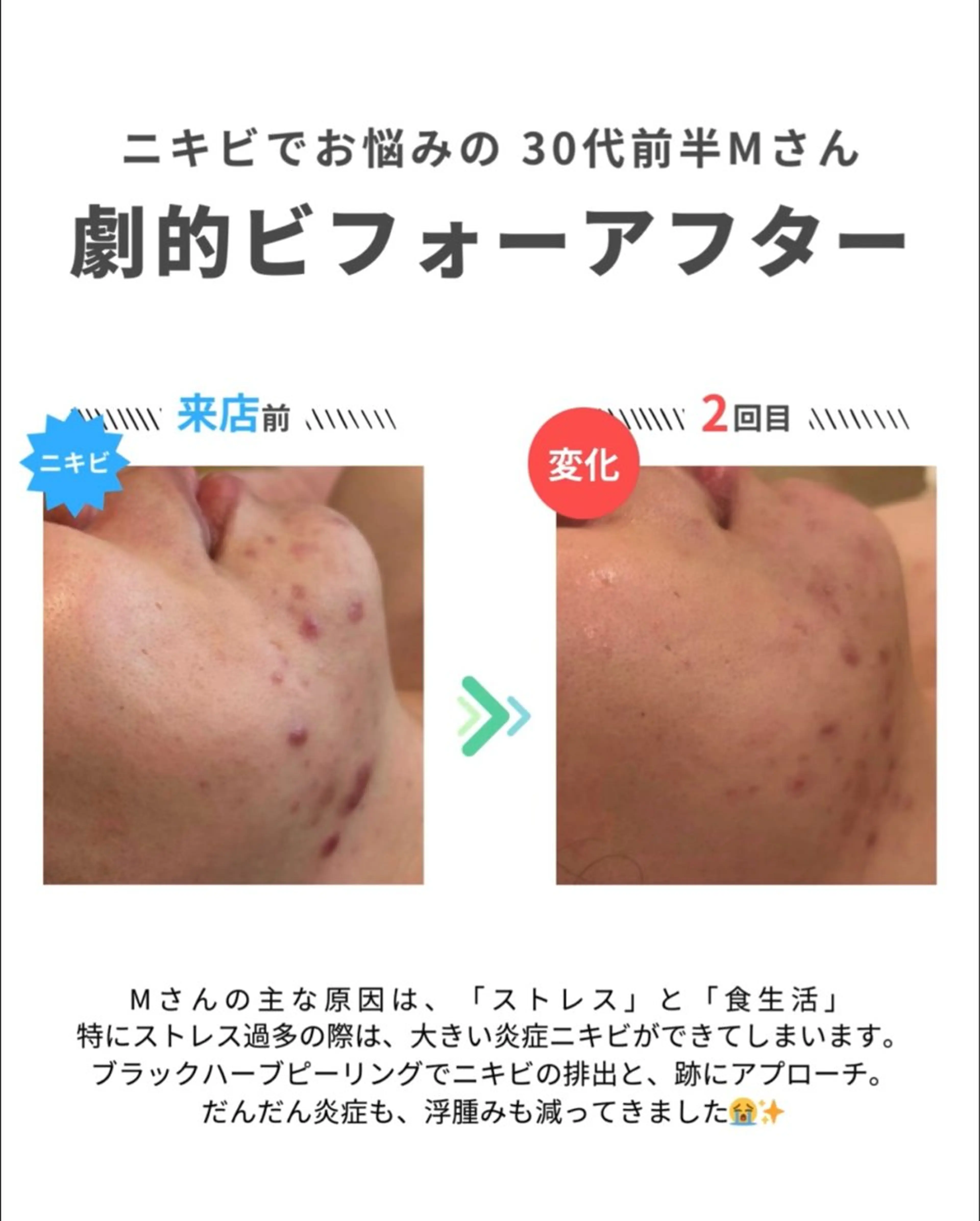 エステ 舟橋 優衣のエステ・リラクイメージ