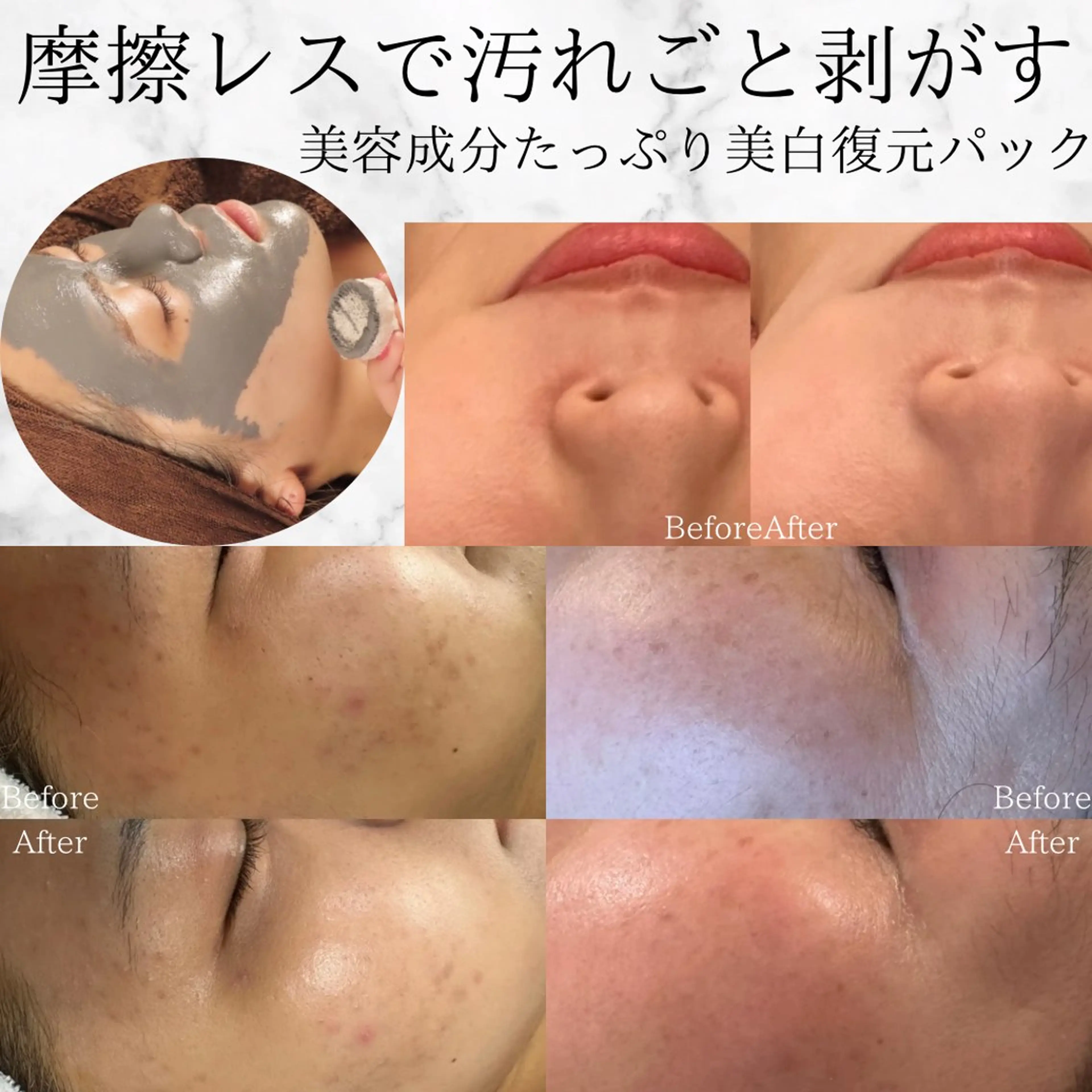 【特別クーポン★説明必読】摩擦レス/SNSでも話題のレチノール配合/根本改善に特化した復元パックで感動の美白美肌にの写真